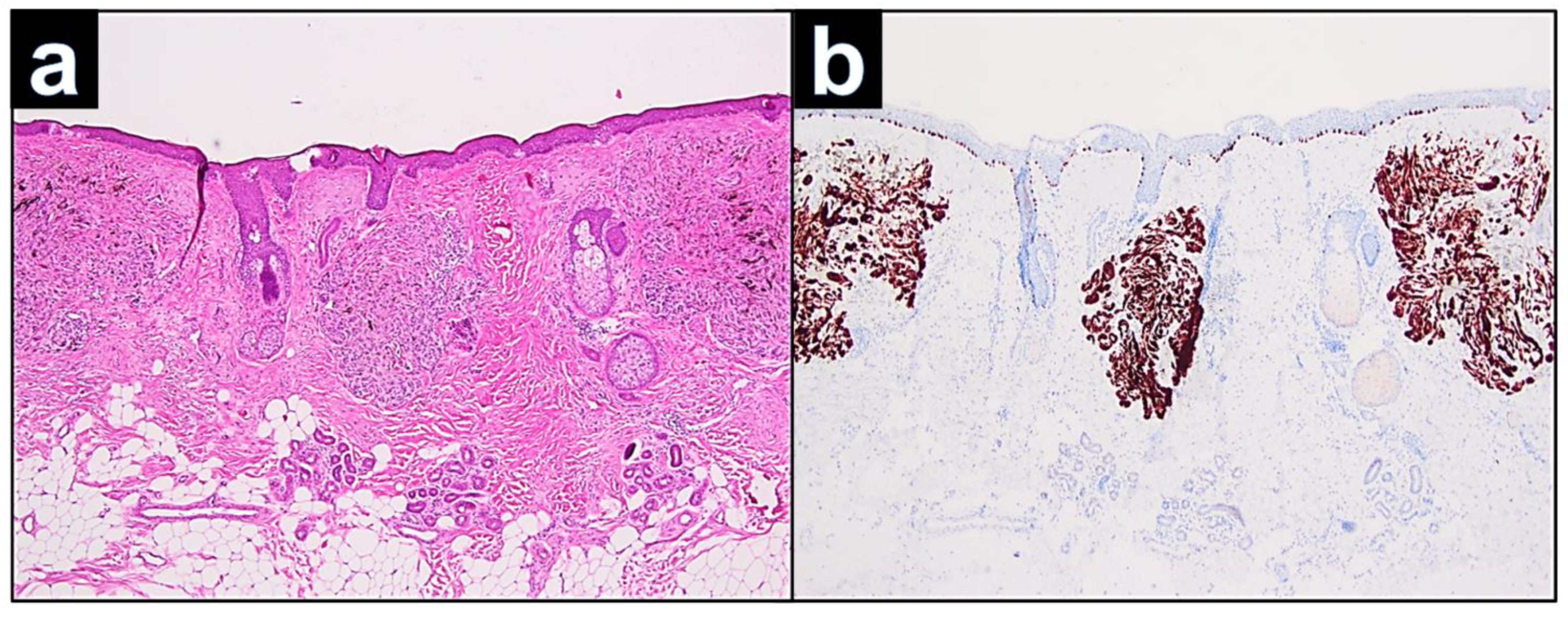 Dermatopathology 09 00042 g002 Dermatopathology 09 00042 g002