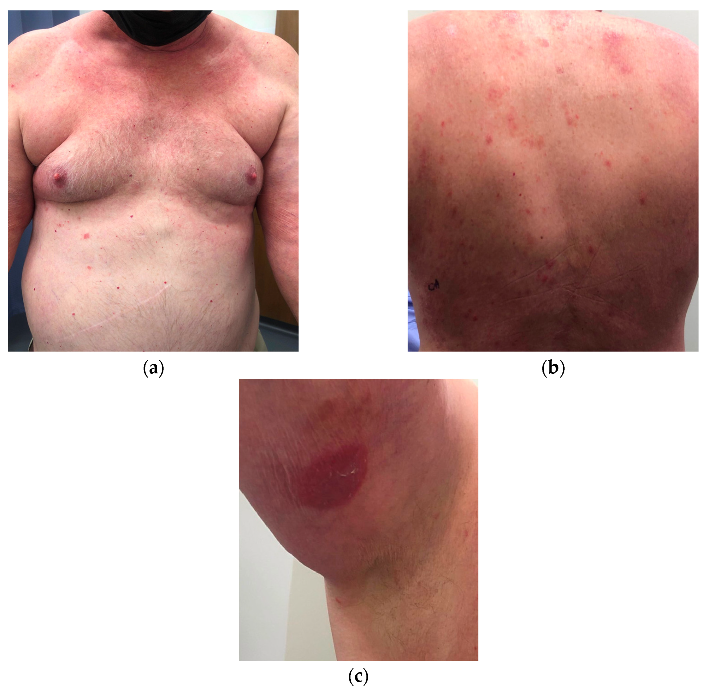 Dermatopathology 09 00045 g001 Dermatopathology 09 00045 g001