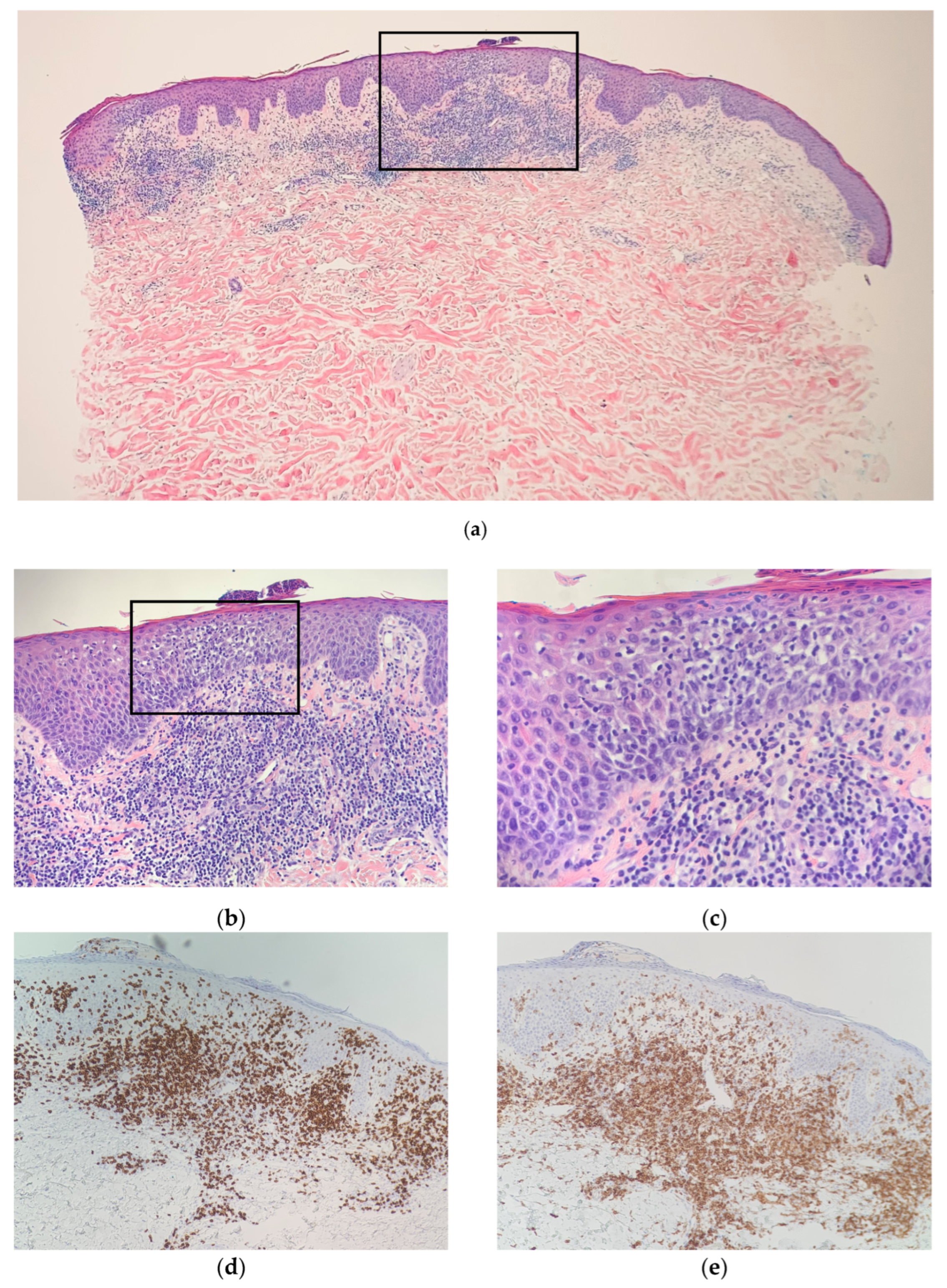 Dermatopathology 09 00045 g002 Dermatopathology 09 00045 g002