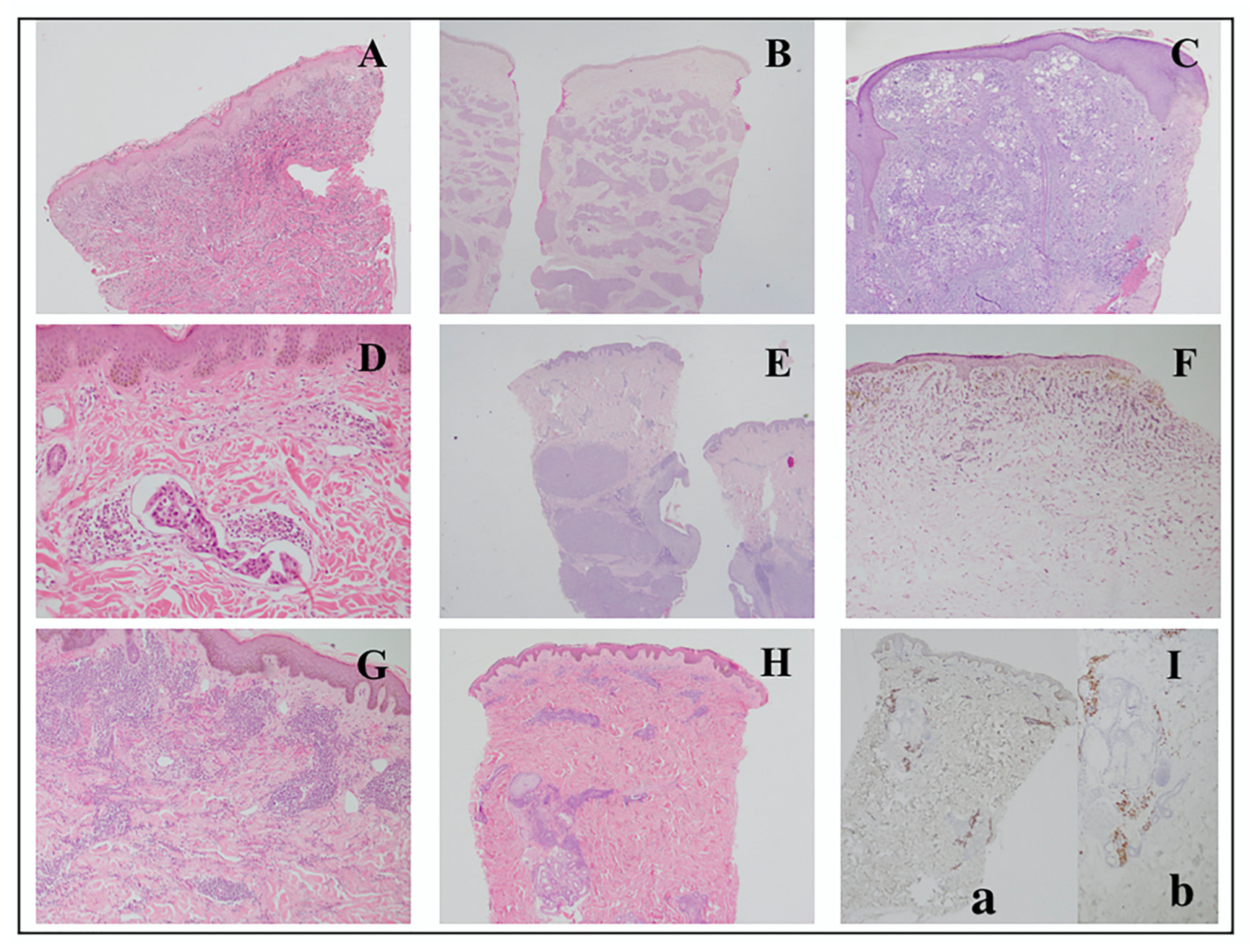 Dermatopathology 09 00046 g004 Dermatopathology 09 00046 g004