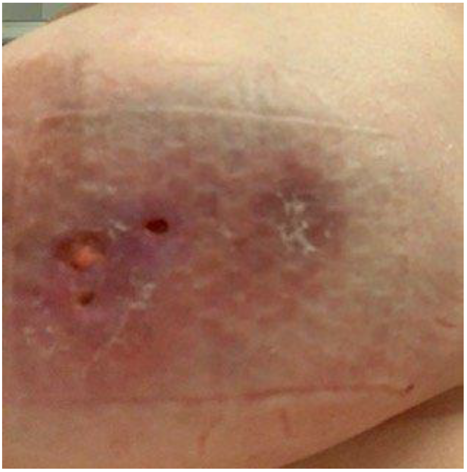 Dermatopathology 09 00047 g002