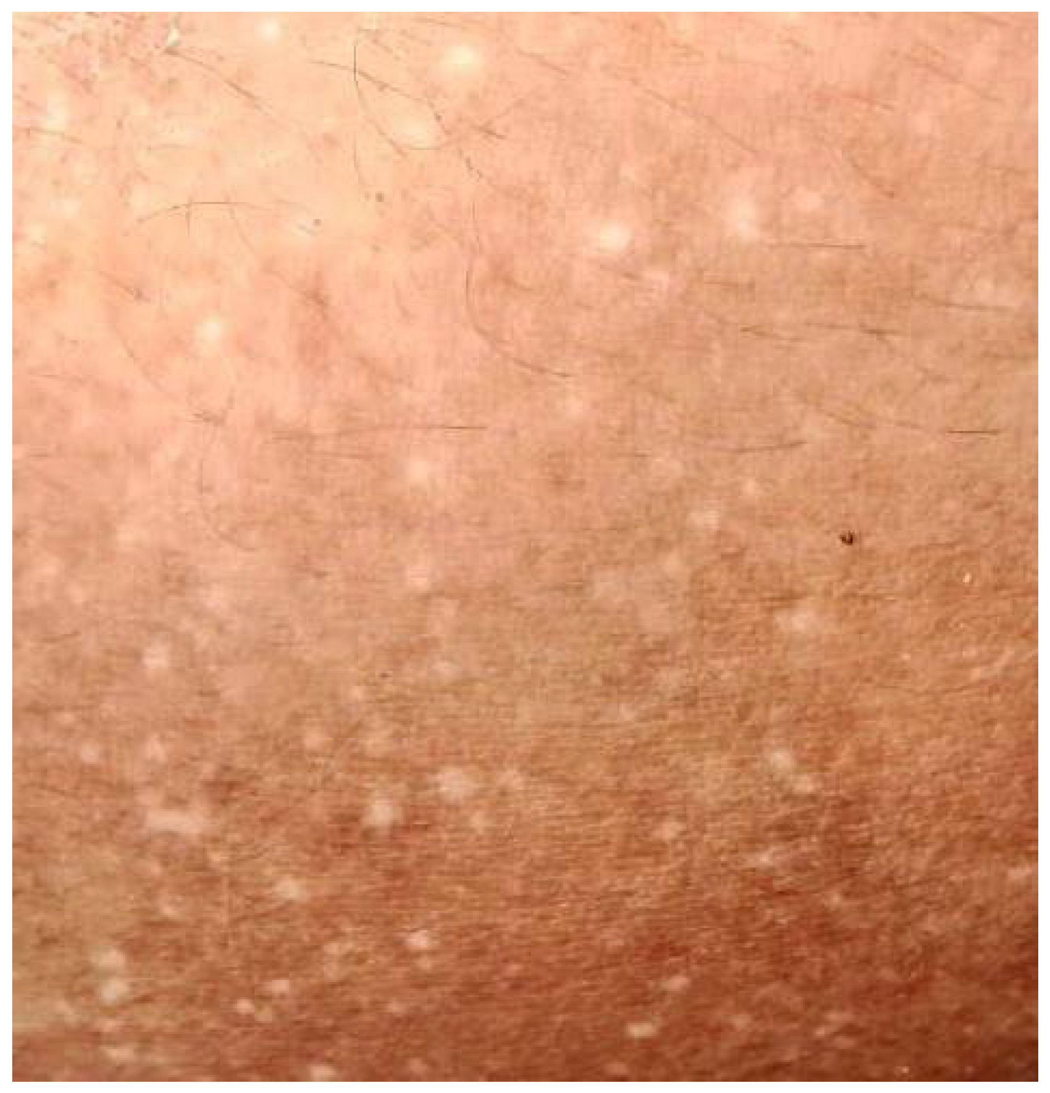 Dermatopathology 10 00002 g002