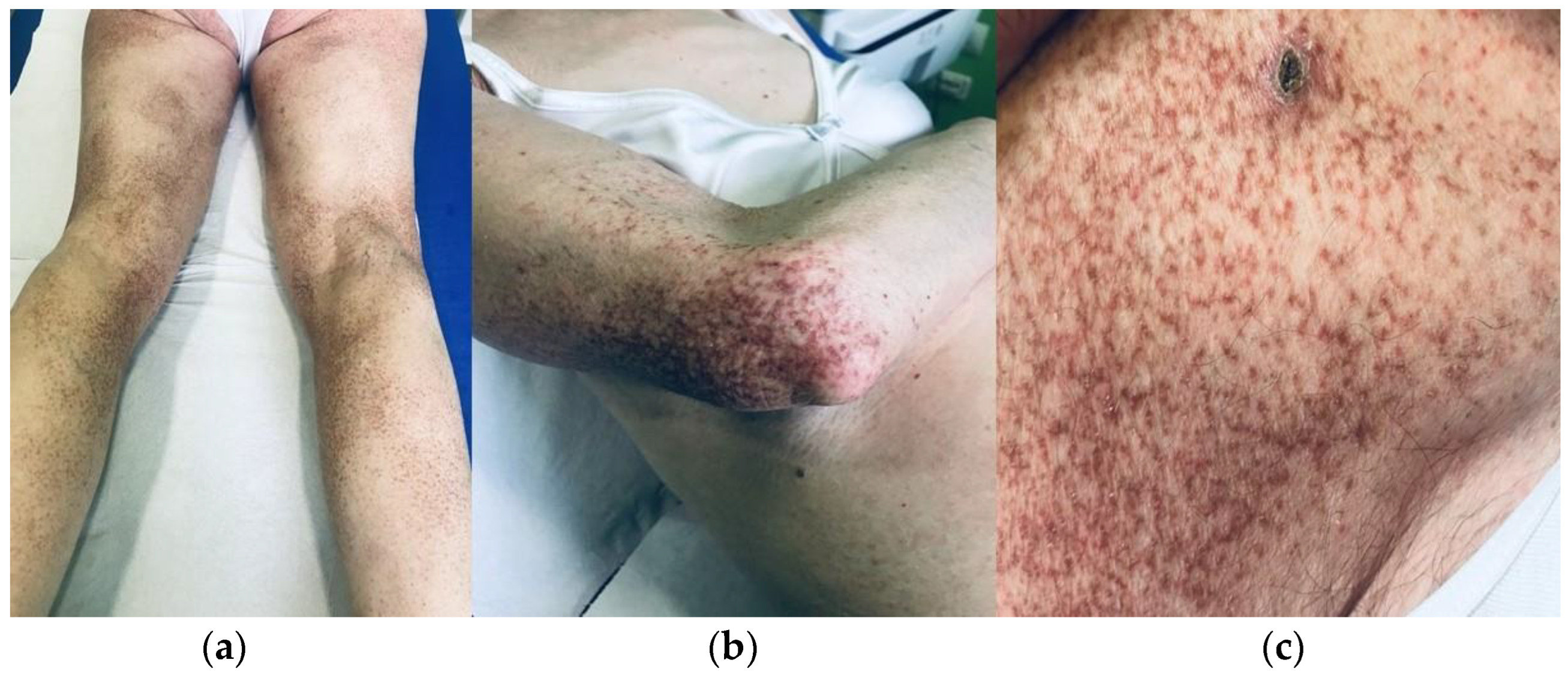 Dermatopathology 10 00006 g001