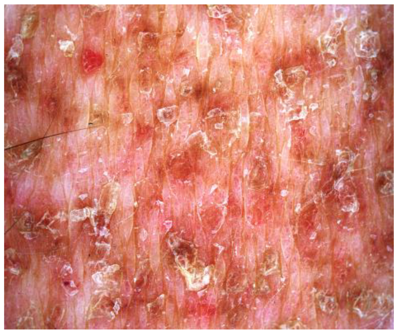 Dermatopathology 10 00006 g002