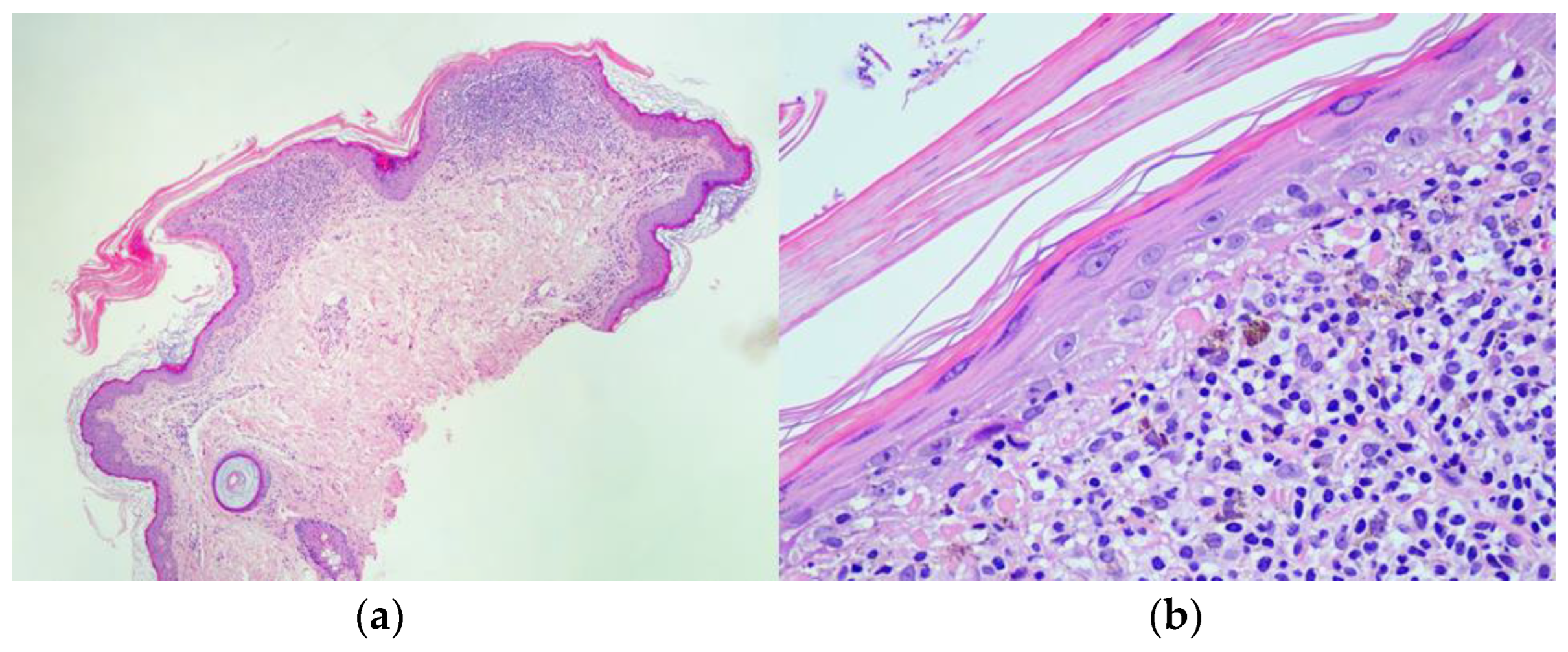 Dermatopathology 10 00006 g003