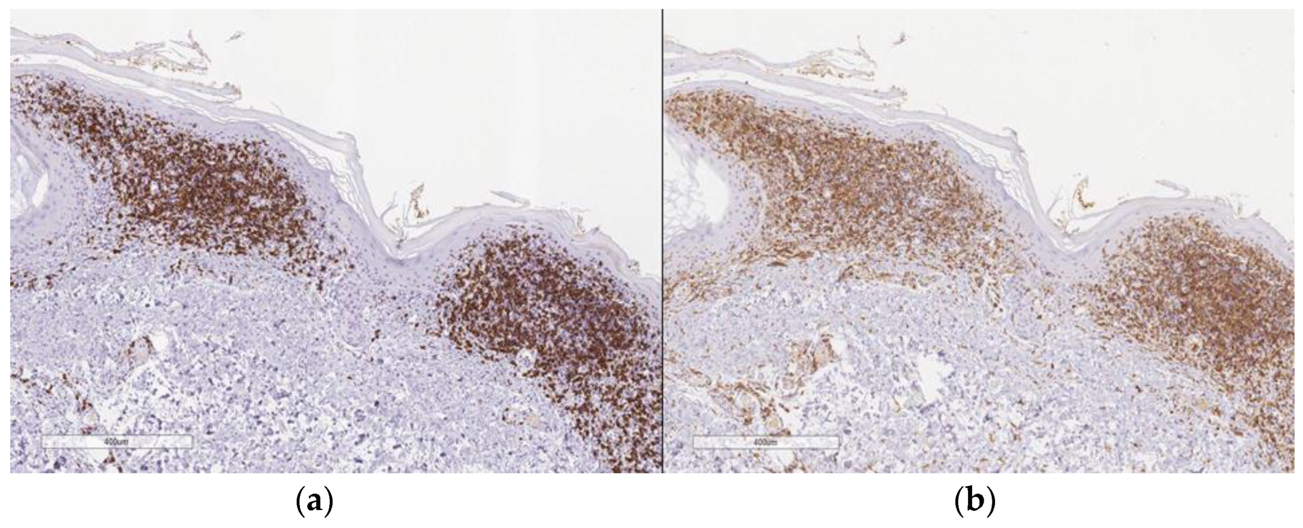 Dermatopathology 10 00006 g004