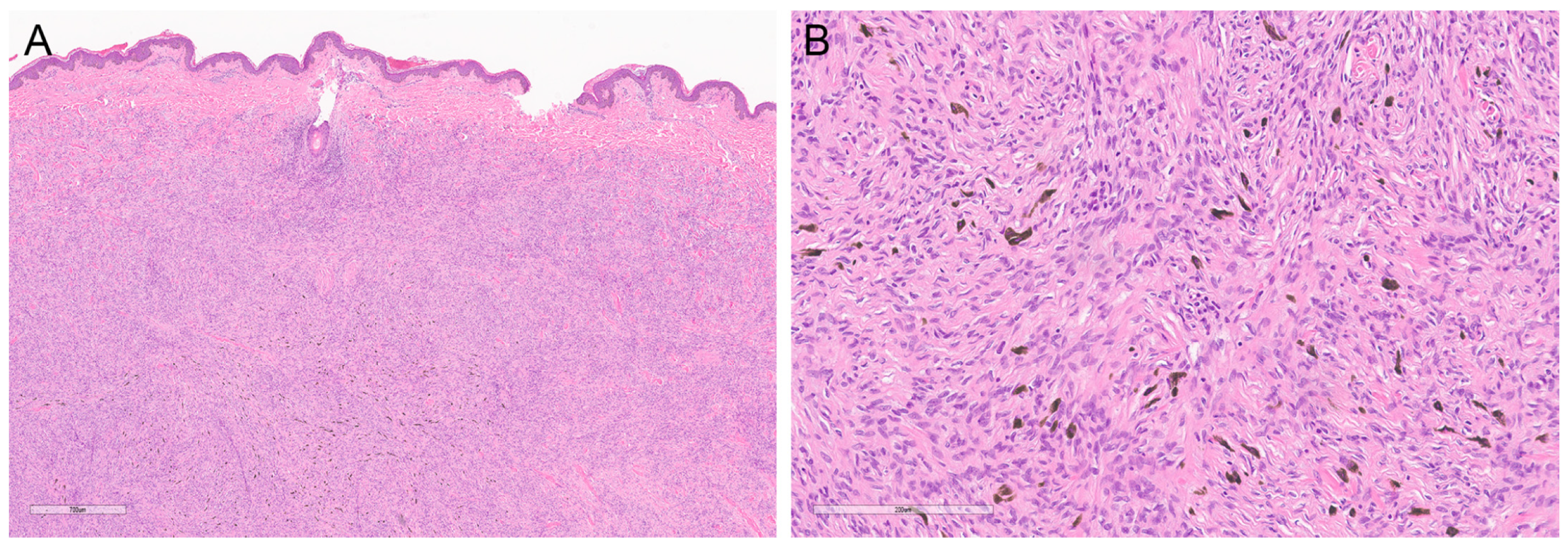 Dermatopathology 10 00008 g003