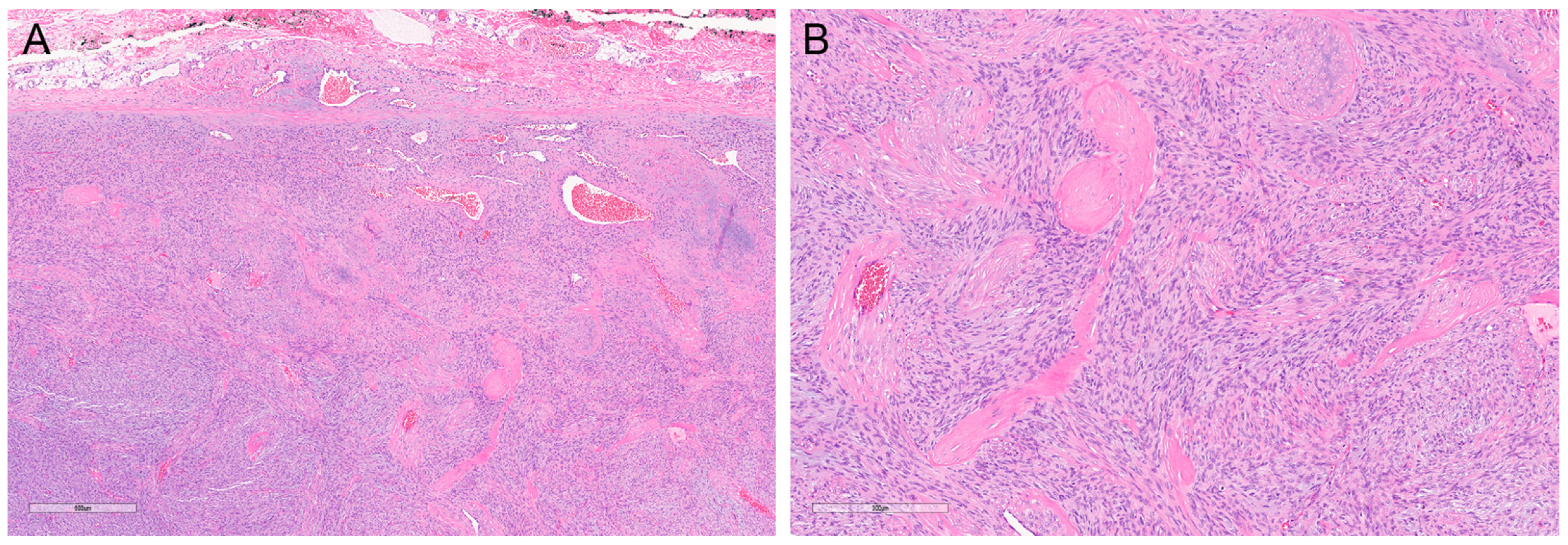 Dermatopathology 10 00008 g004