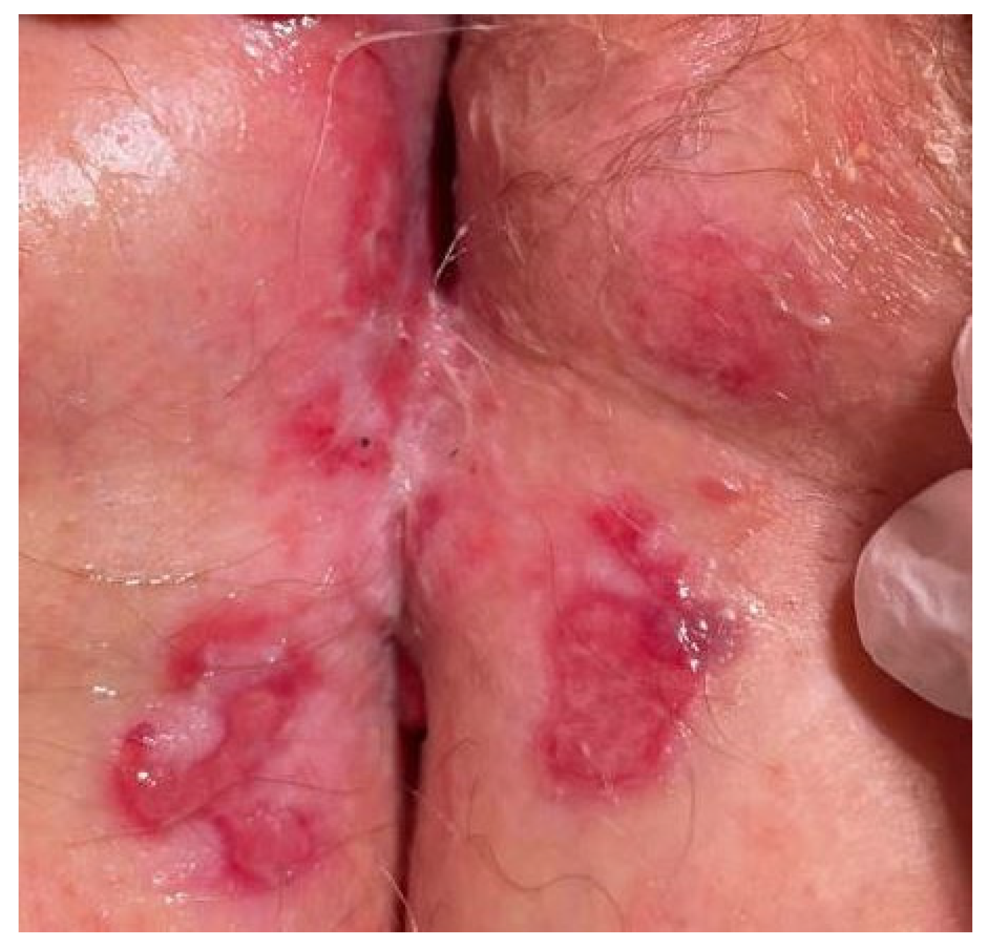 Dermatopathology 10 00009 g002