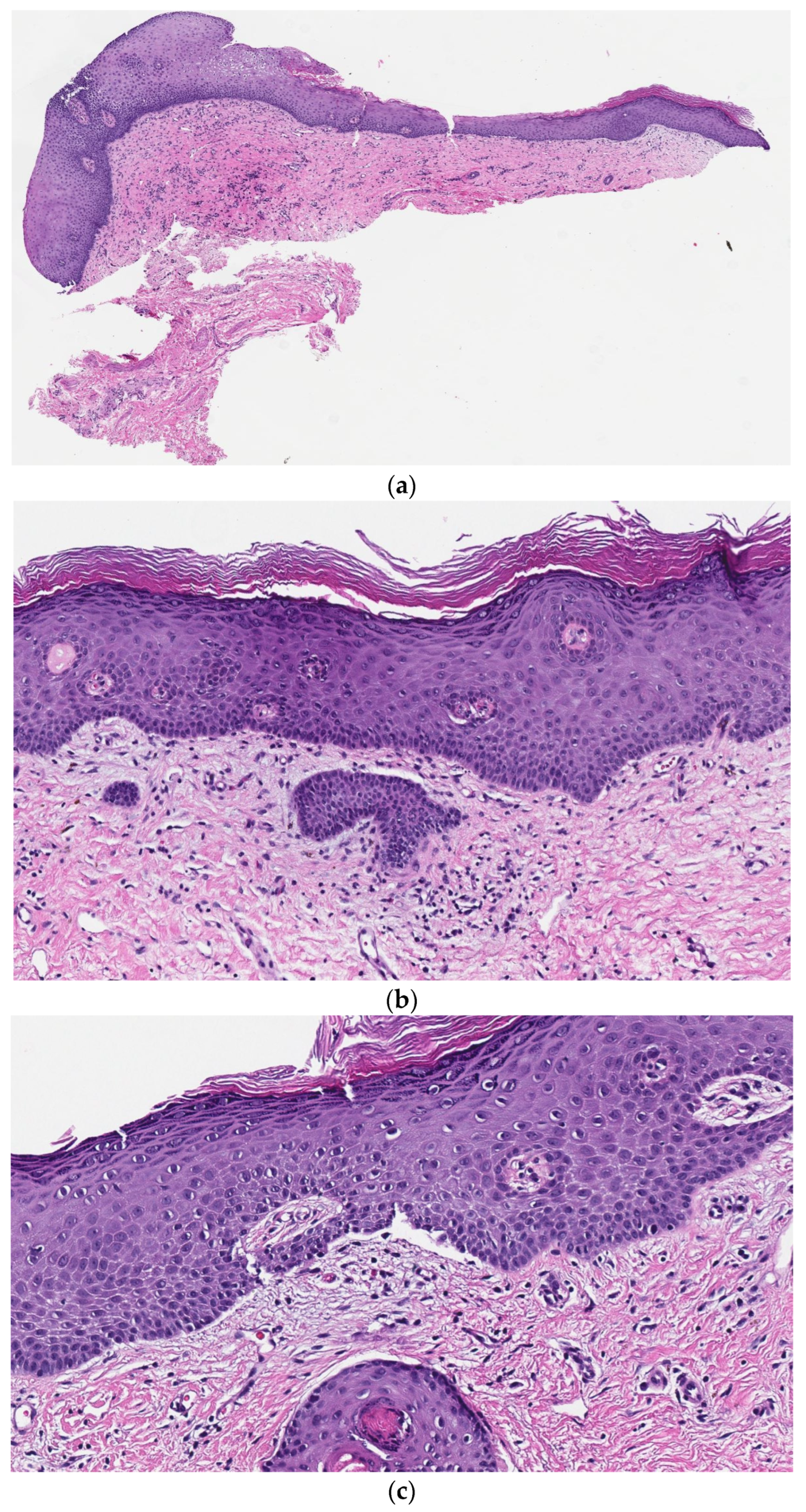 Dermatopathology 10 00009 g003