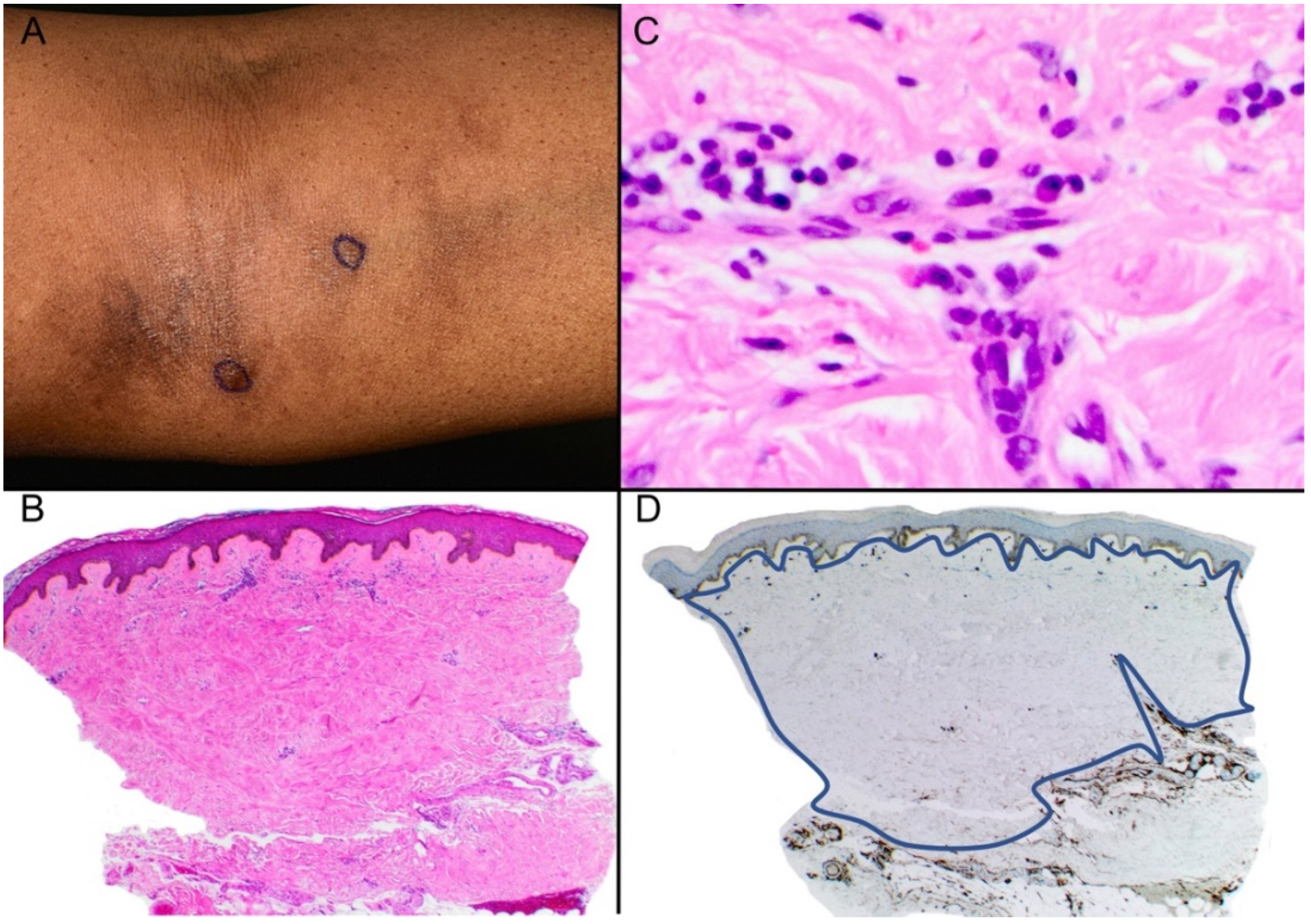 Dermatopathology 10 00010 g003