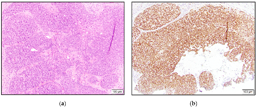 Dermatopathology 10 00011 g002 550