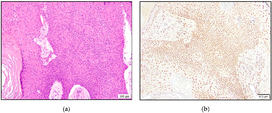 Dermatopathology 10 00011 g005 550