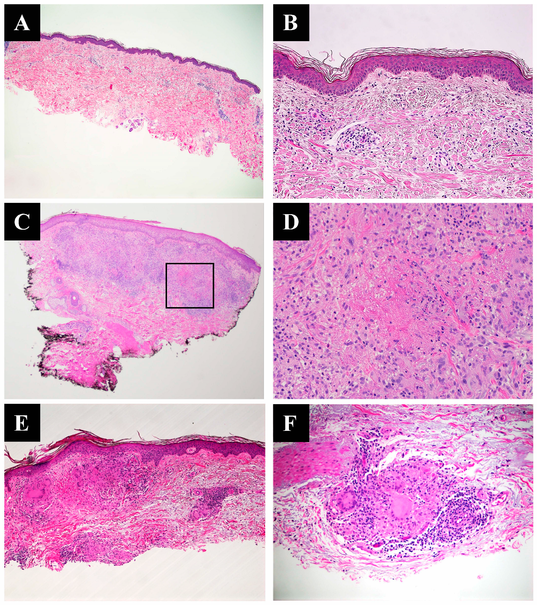 Dermatopathology 10 00015 g001 Dermatopathology 10 00015 g001