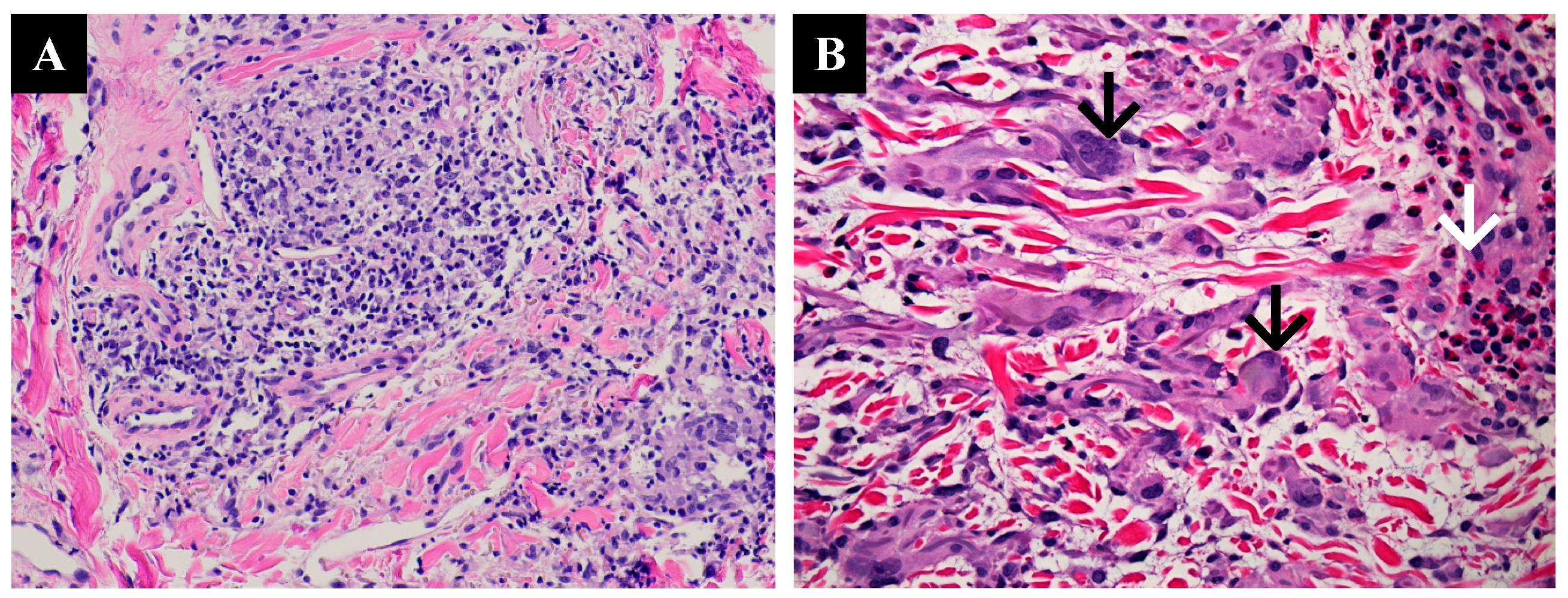 Dermatopathology 10 00015 g002 Dermatopathology 10 00015 g002