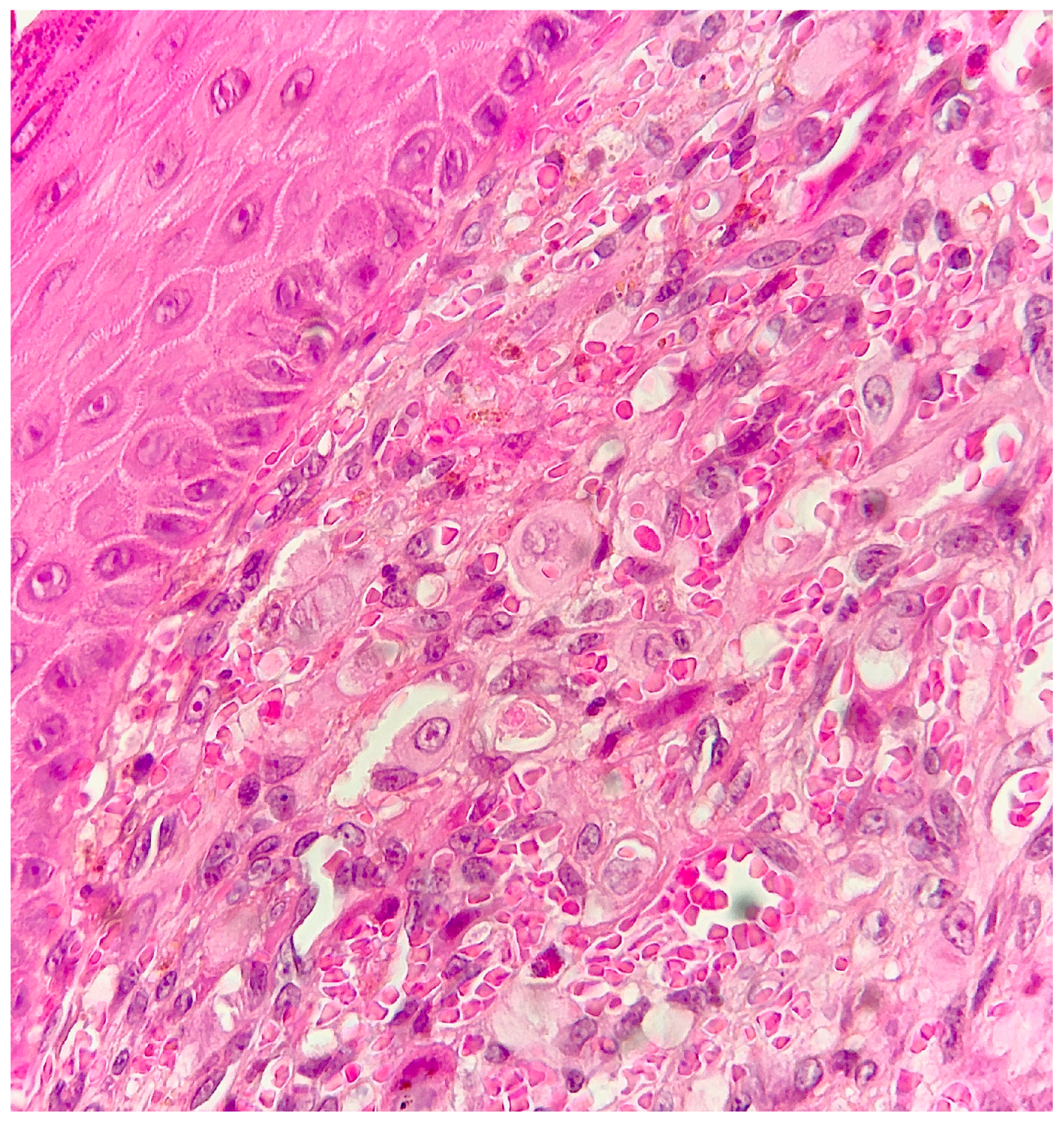 Dermatopathology 10 00017 g004