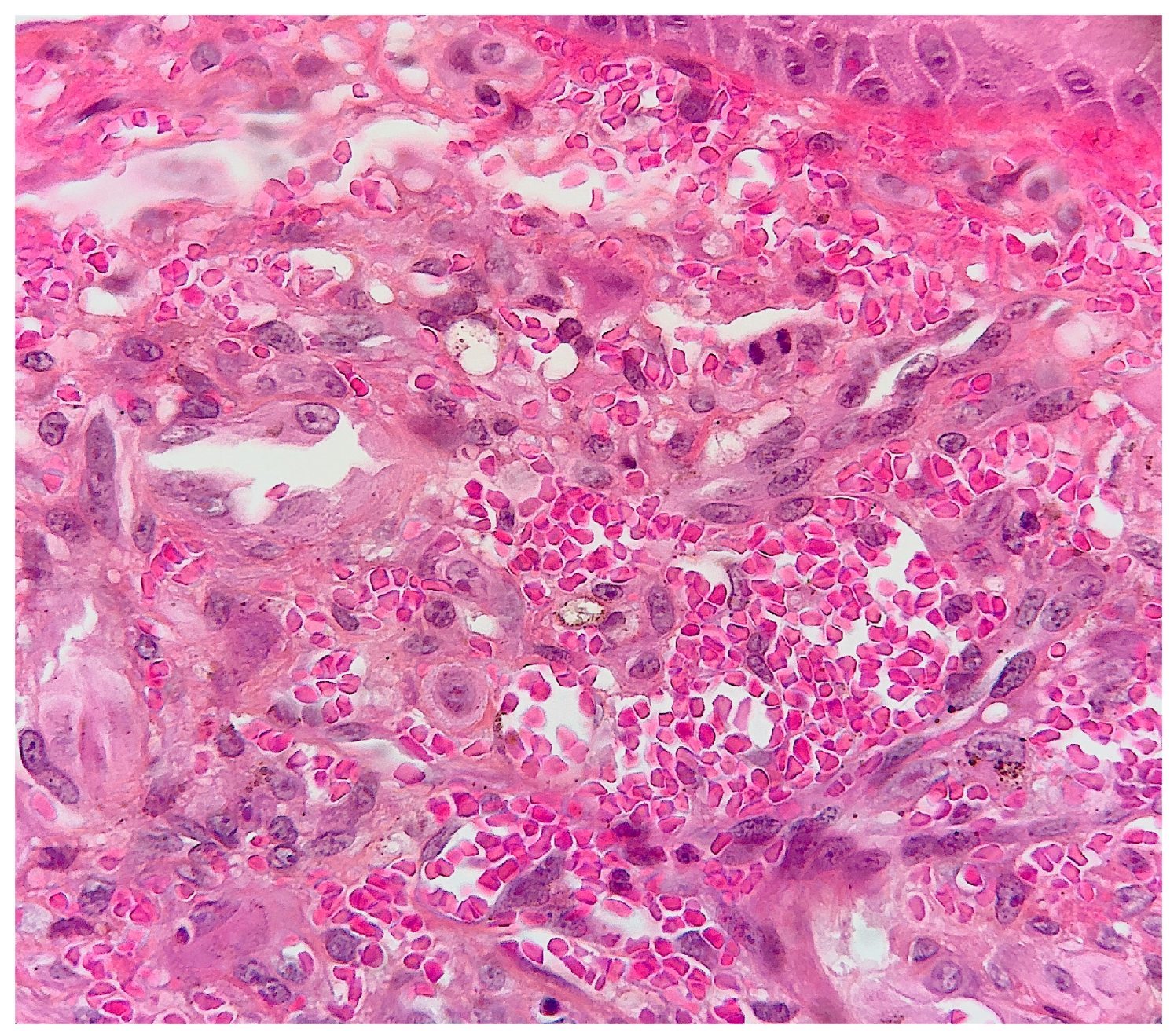 Dermatopathology 10 00017 g005