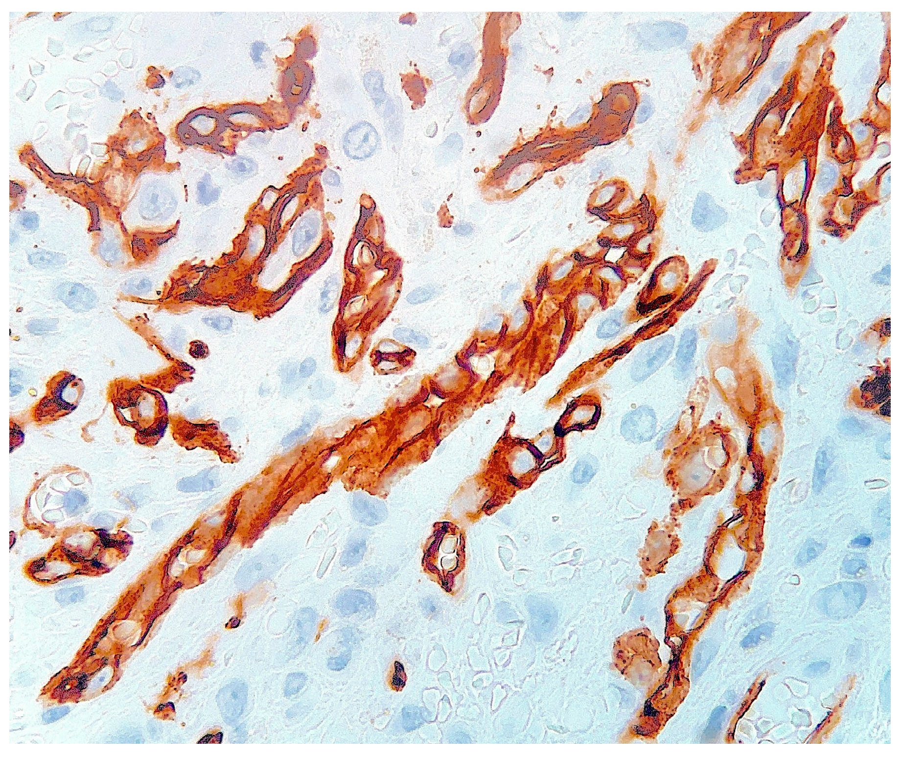 Dermatopathology 10 00017 g007