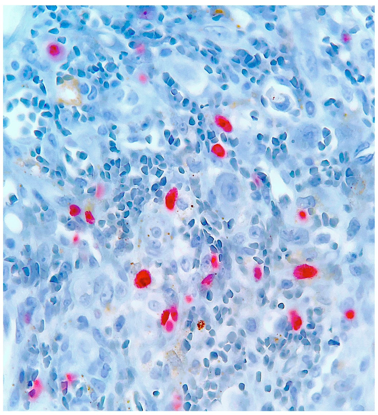 Dermatopathology 10 00017 g010