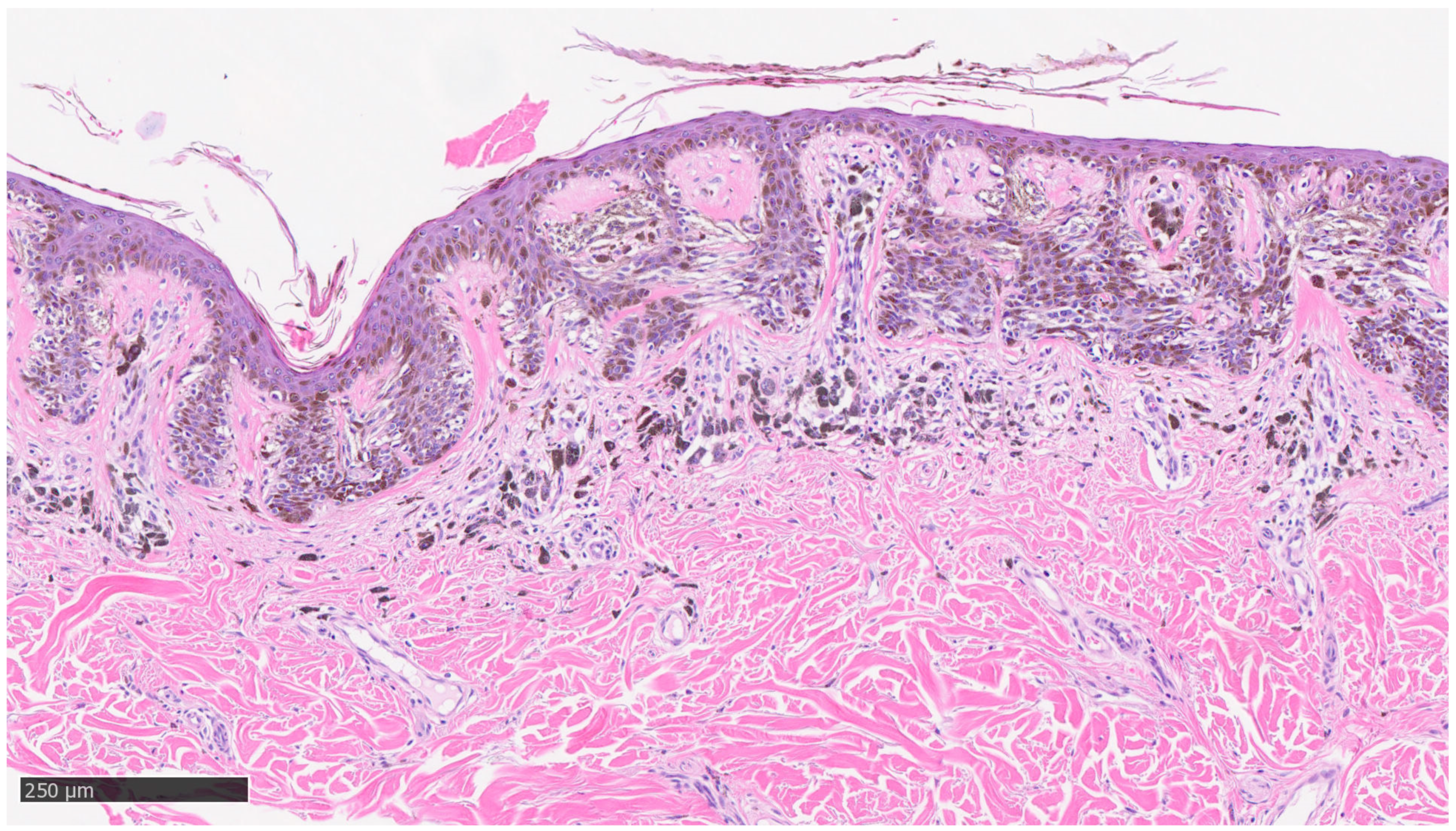 Dermatopathology 10 00018 g002 Dermatopathology 10 00018 g002