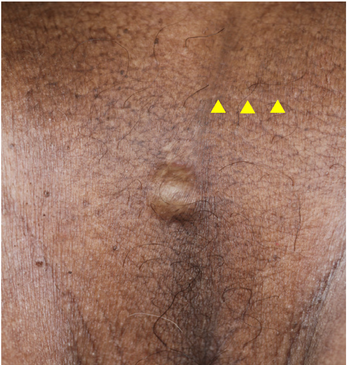 Dermatopathology 10 00019 g003 Dermatopathology 10 00019 g003