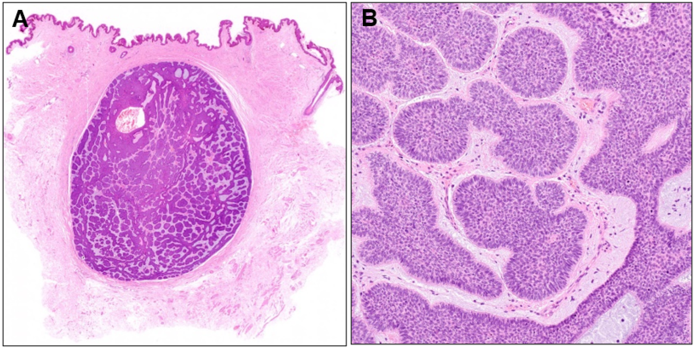 Dermatopathology 10 00019 g004 Dermatopathology 10 00019 g004