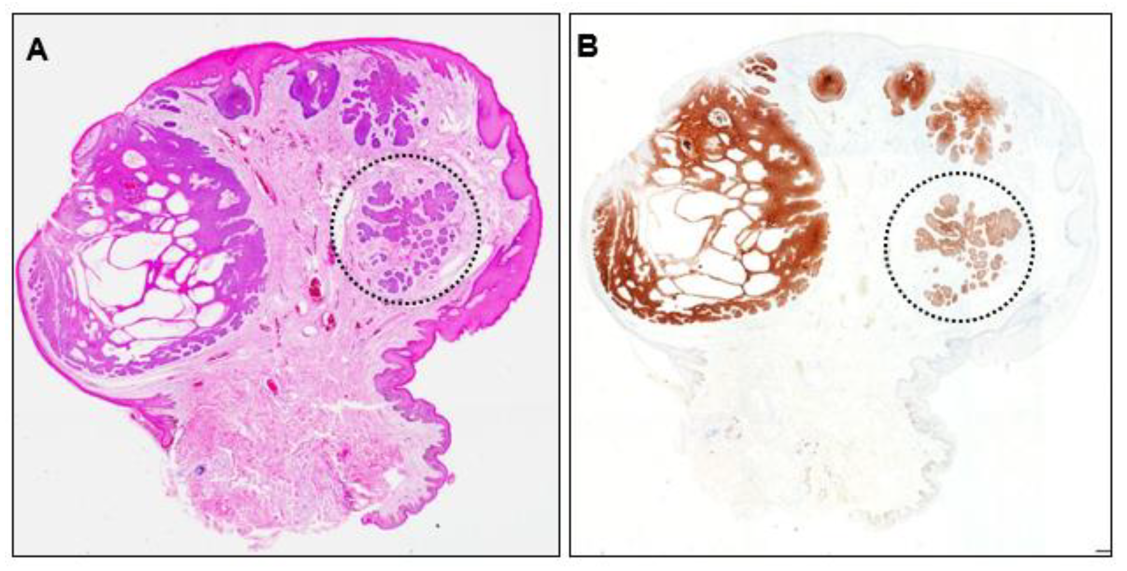 Dermatopathology 10 00019 g005 Dermatopathology 10 00019 g005