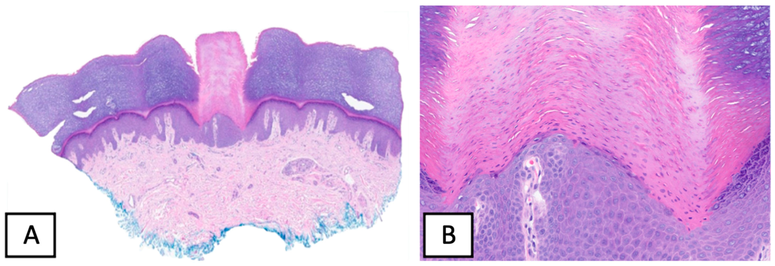 Dermatopathology 10 00021 g002