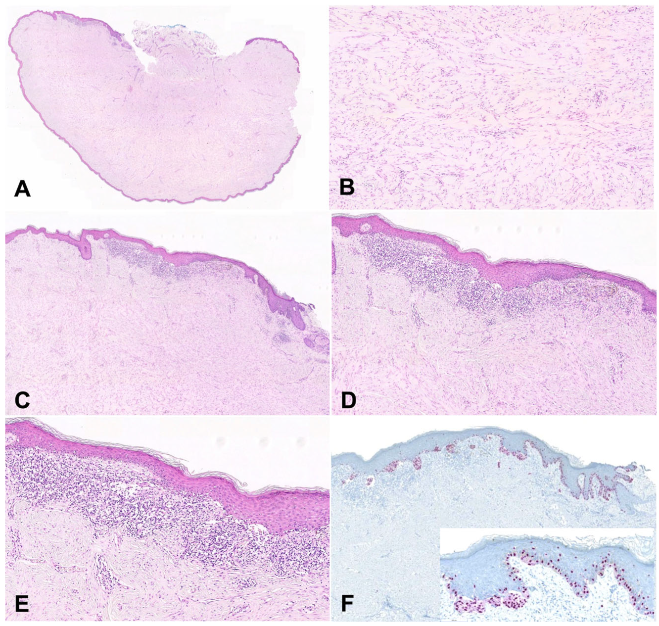 Dermatopathology 10 00028 g001