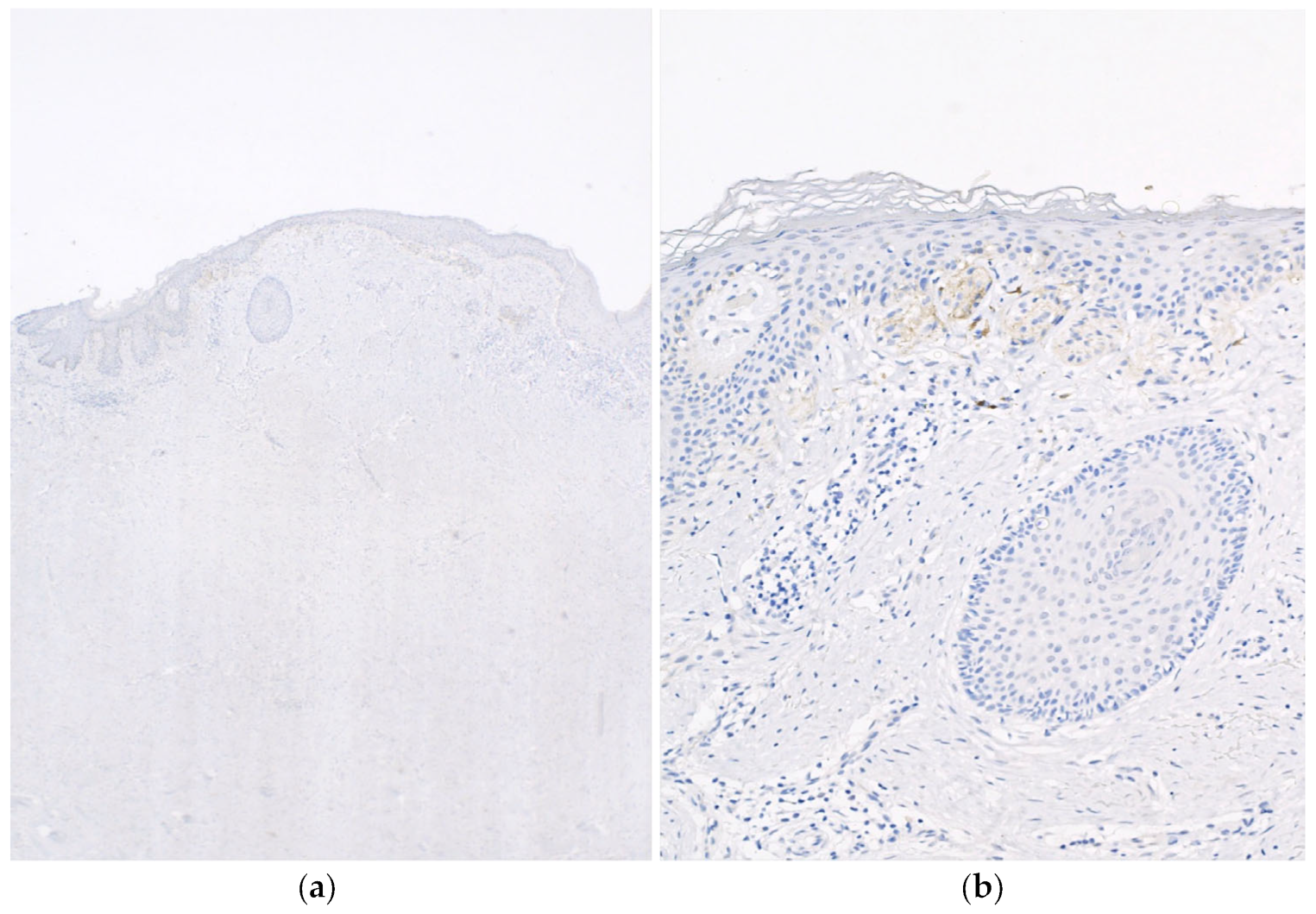 Dermatopathology 10 00028 g002