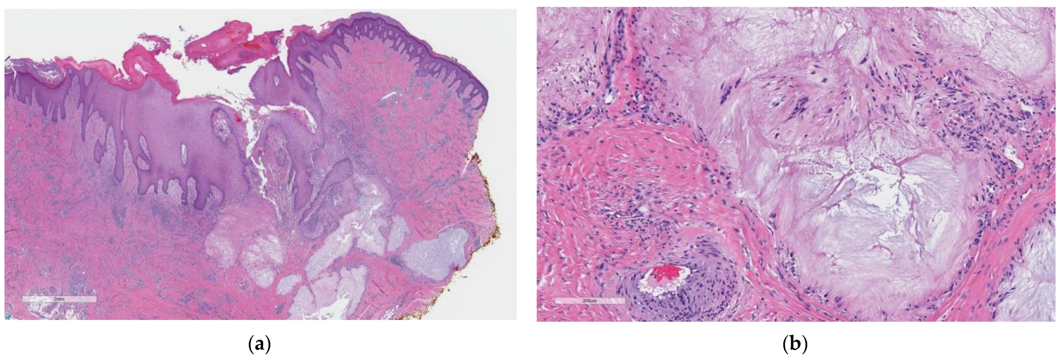 Dermatopathology 10 00029 g001