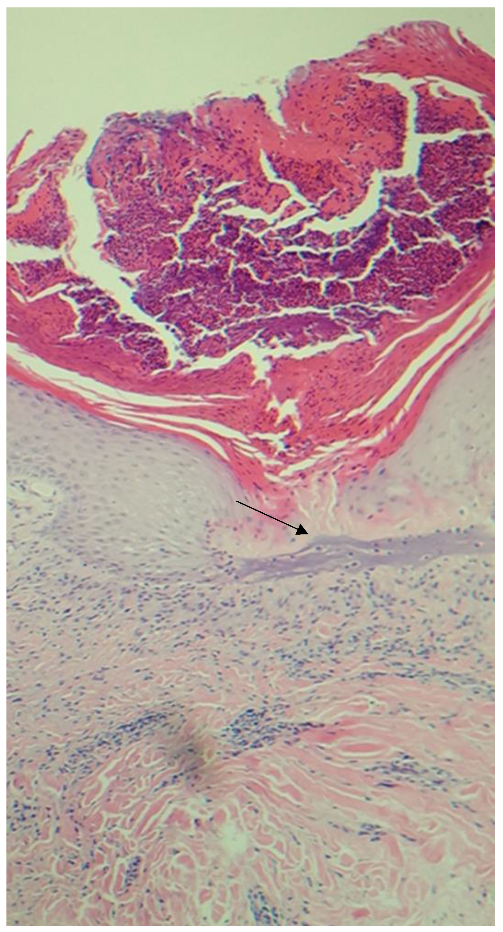 Dermatopathology 10 00029 g0a2