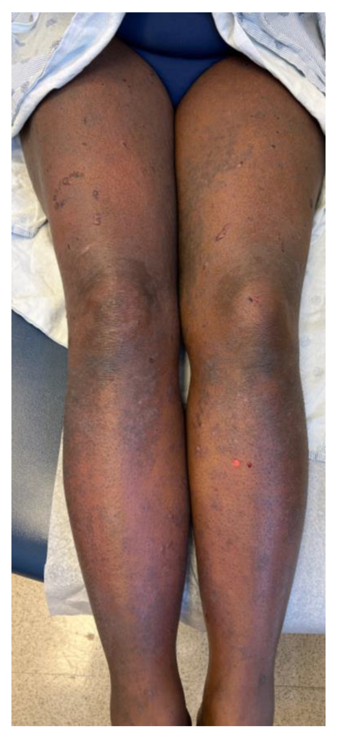 Dermatopathology 10 00033 g001