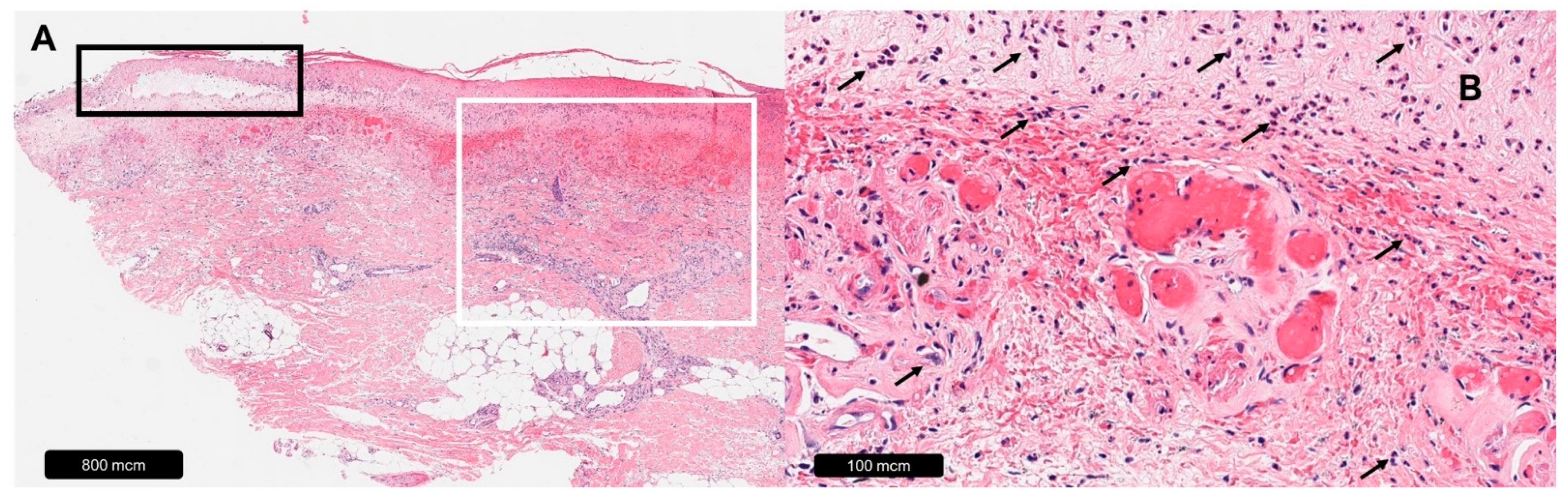 Dermatopathology 11 00007 g002 Dermatopathology 11 00007 g002