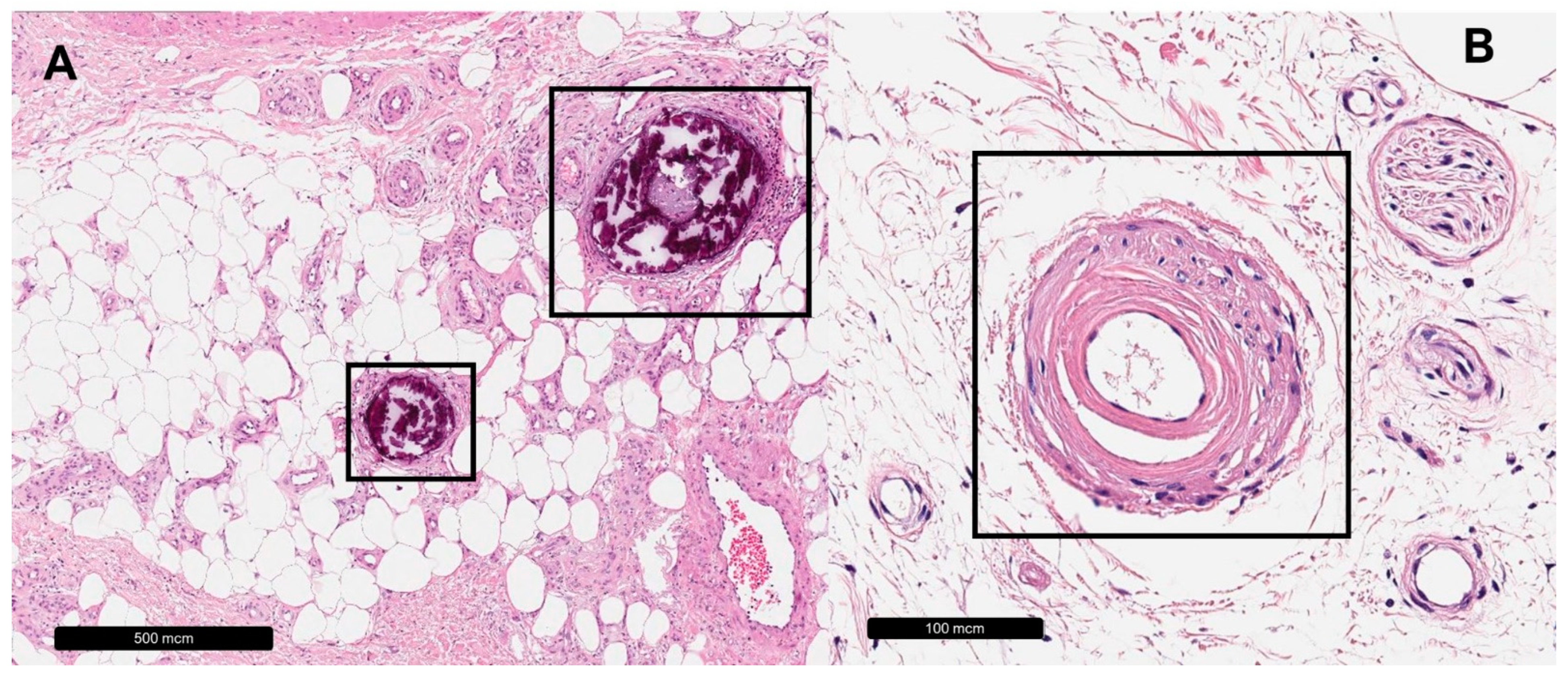 Dermatopathology 11 00007 g003 Dermatopathology 11 00007 g003