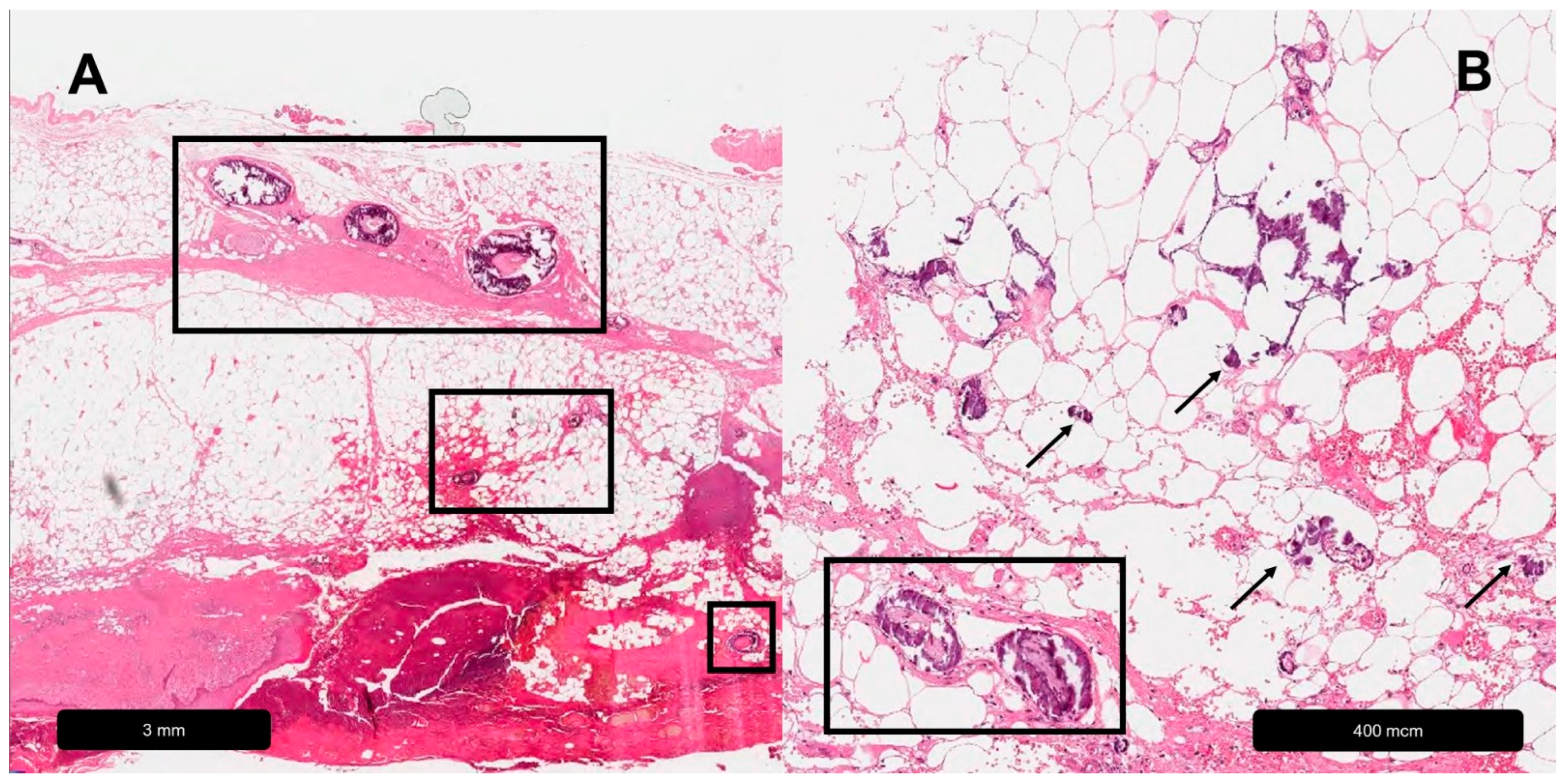 Dermatopathology 11 00007 g004 Dermatopathology 11 00007 g004