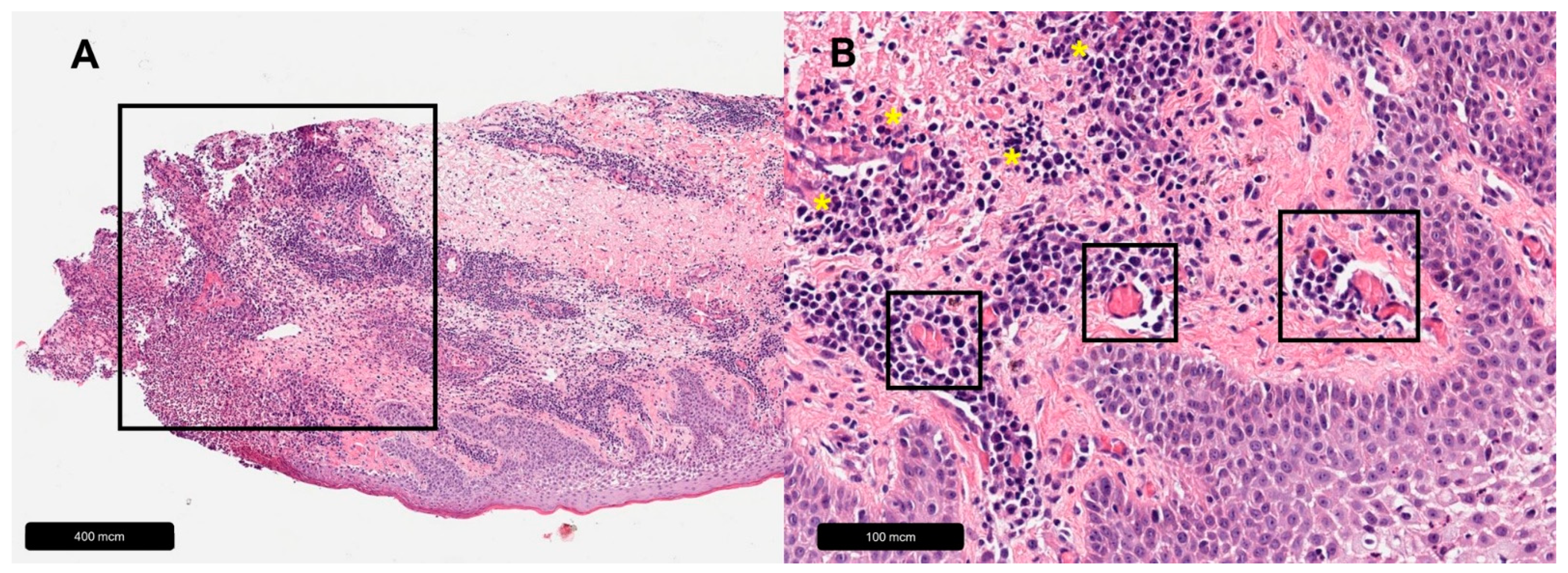 Dermatopathology 11 00007 g005 Dermatopathology 11 00007 g005