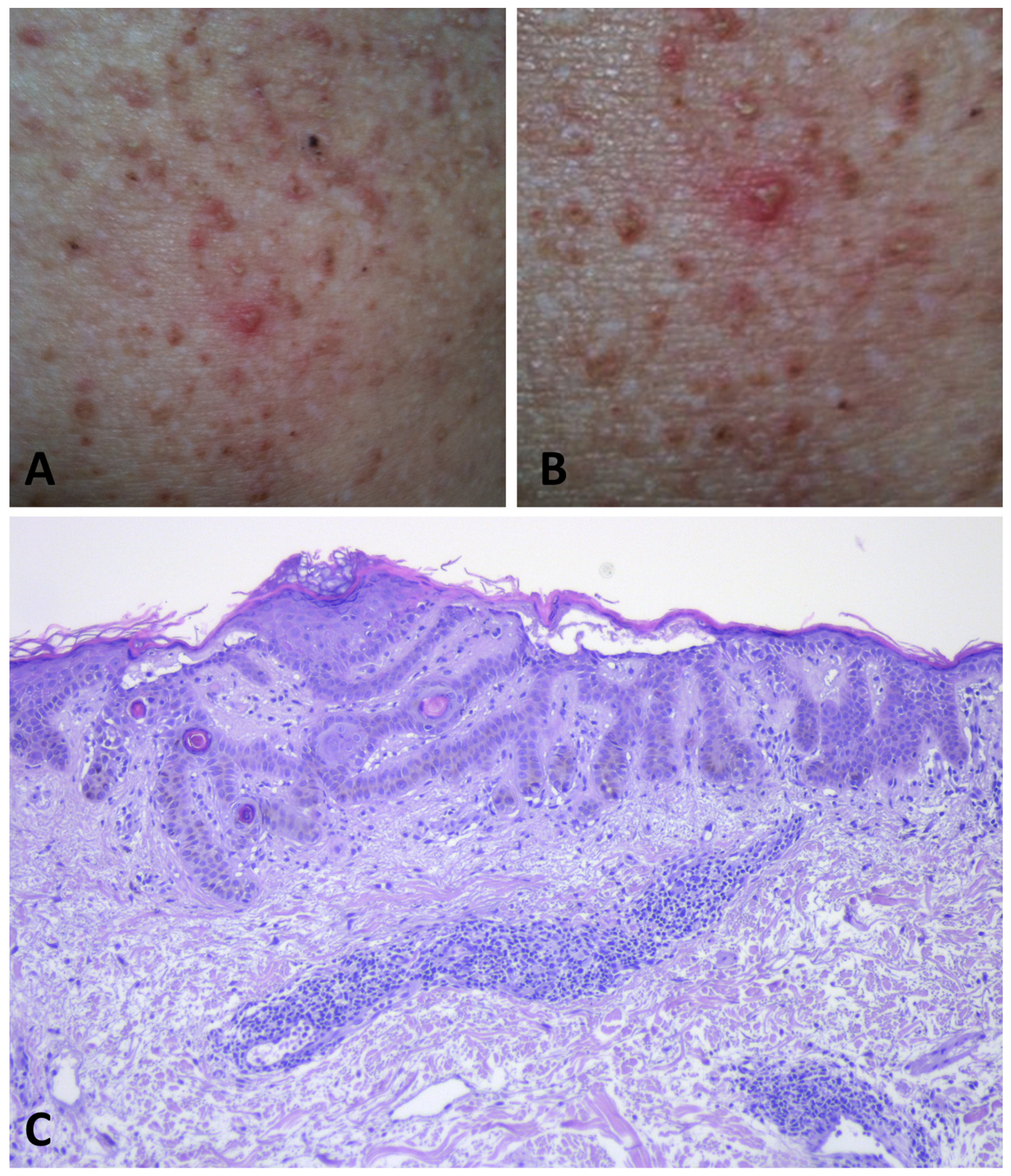 Dermatopathology 11 00008 g005