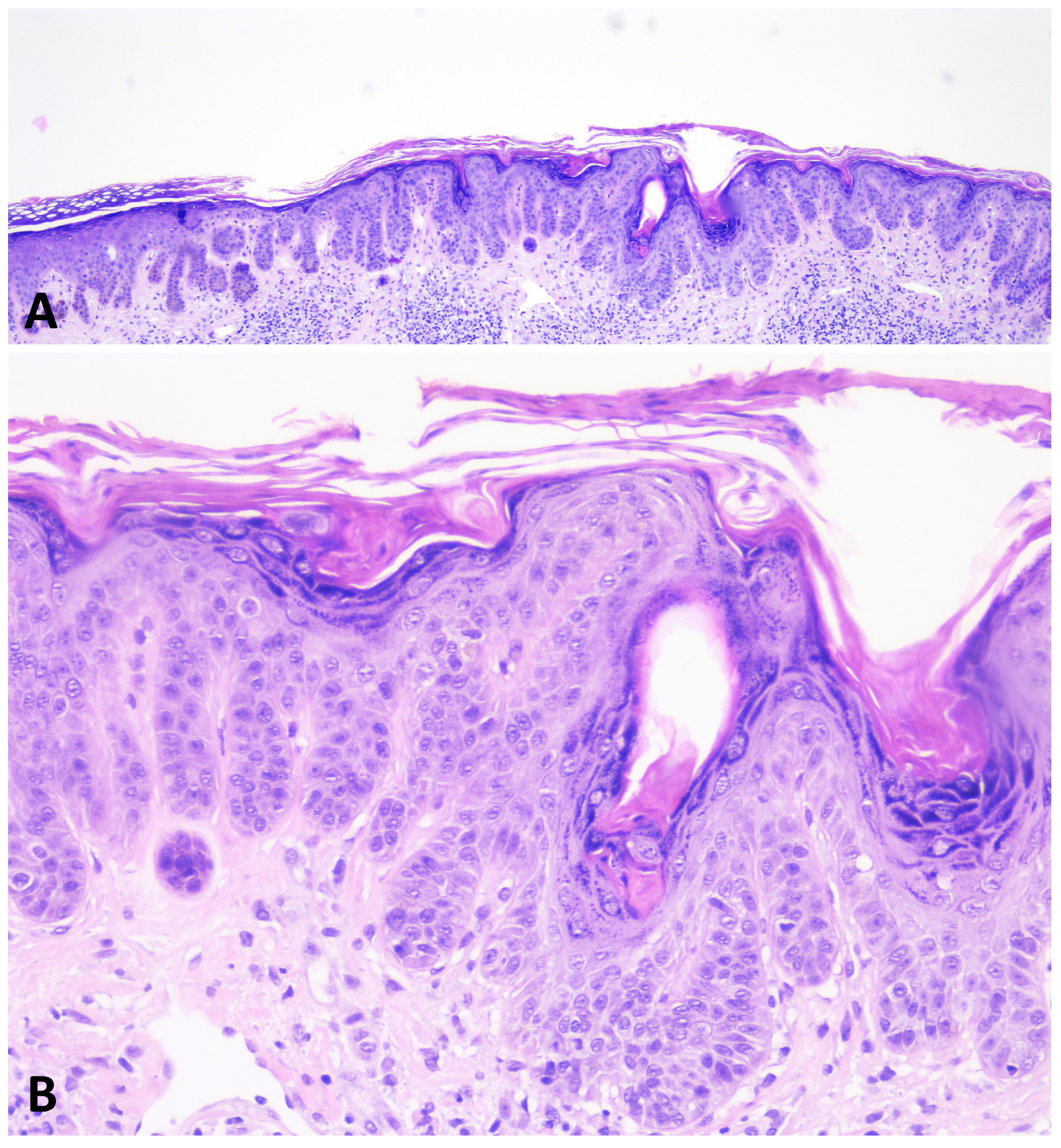 Dermatopathology 11 00008 g006