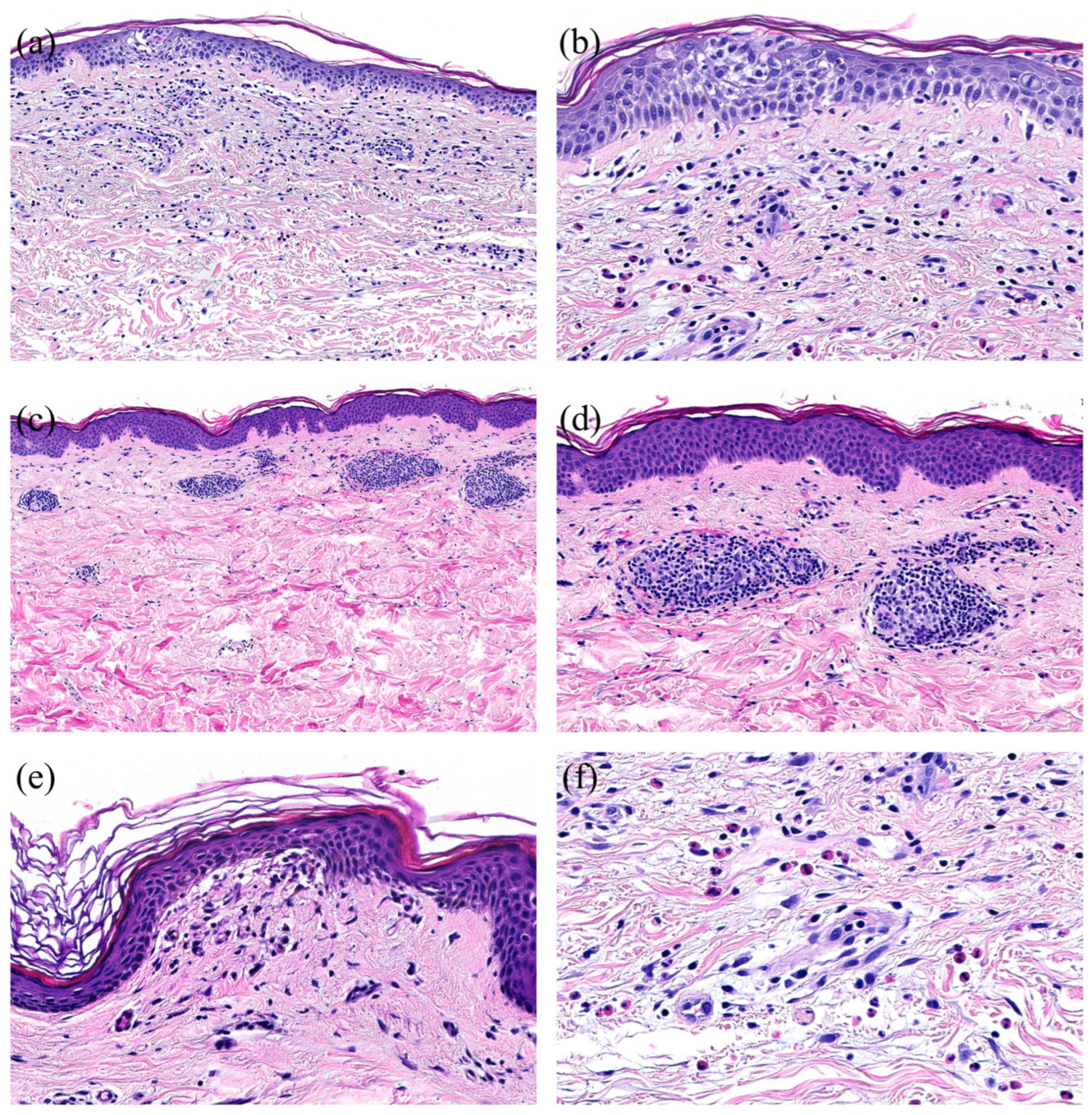 Dermatopathology 11 00013 g004