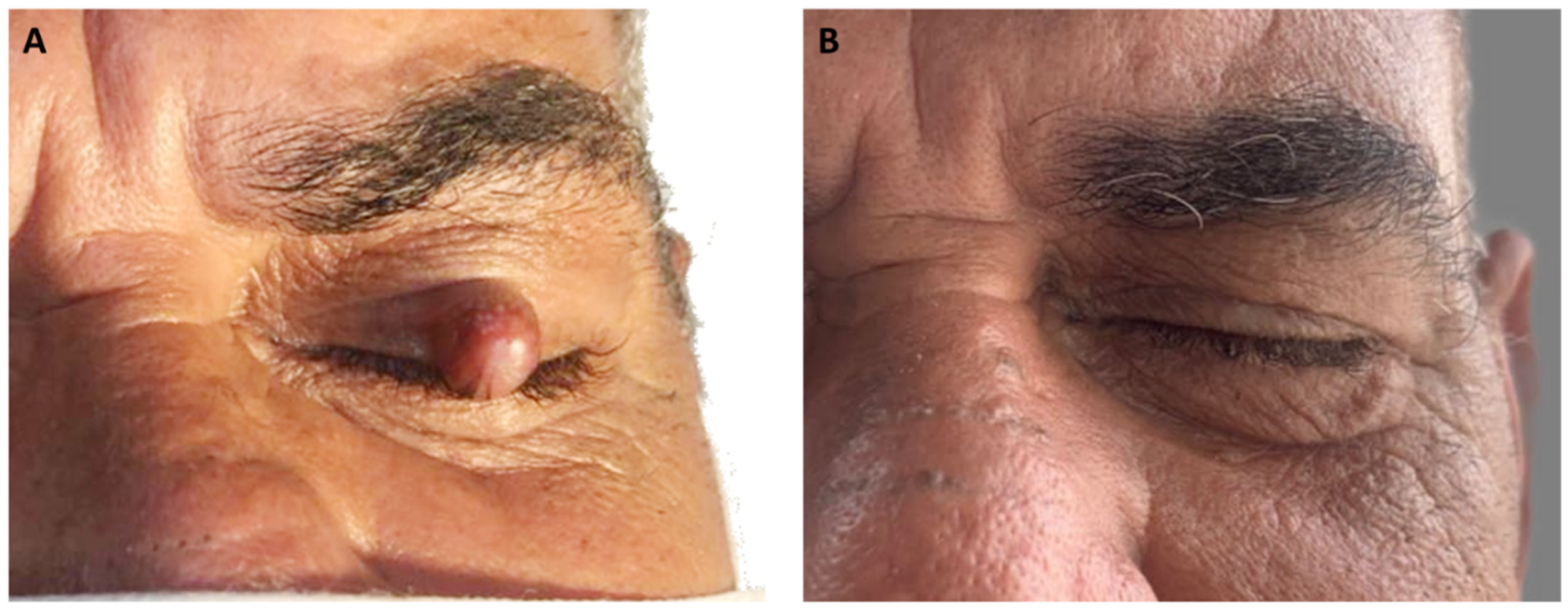 Dermatopathology 11 00014 g001