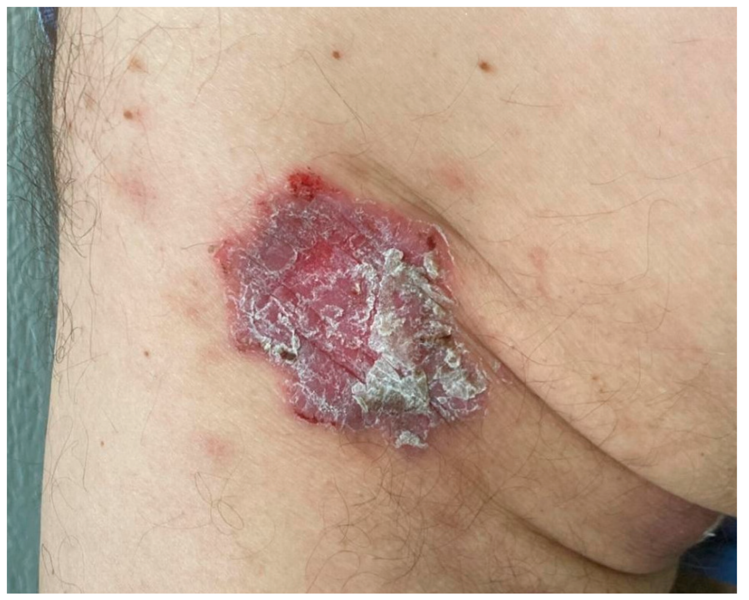 Dermatopathology 11 00015 g001