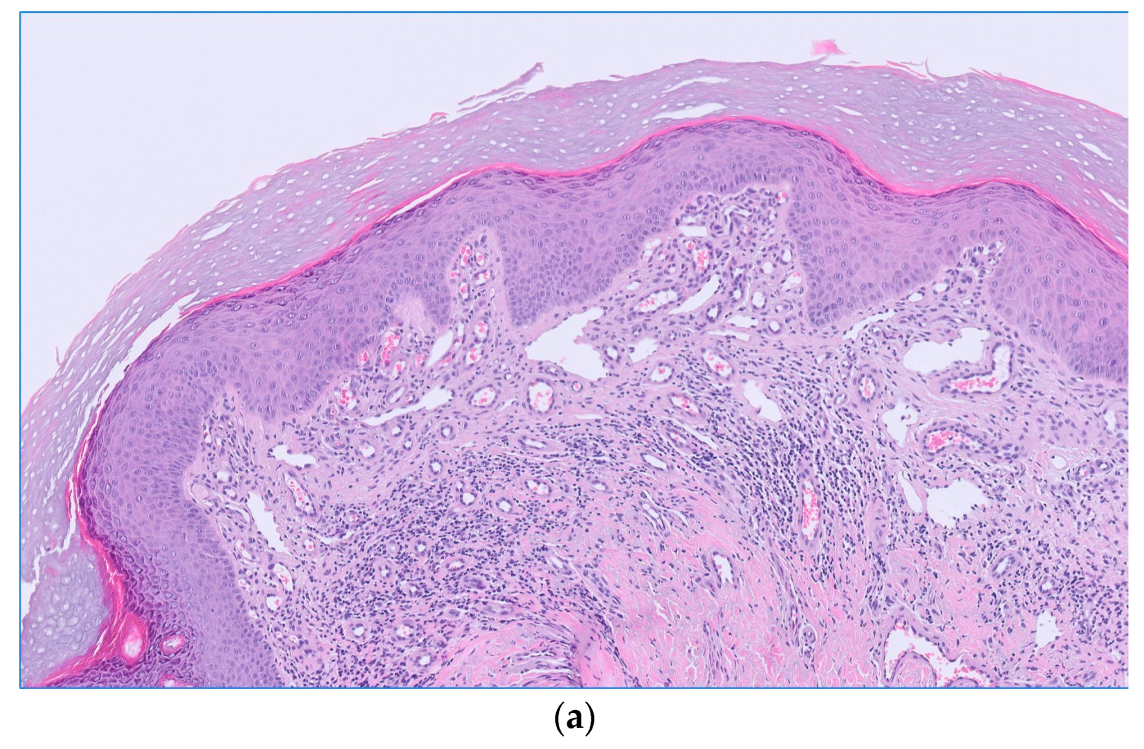 Dermatopathology 11 00015 g002a