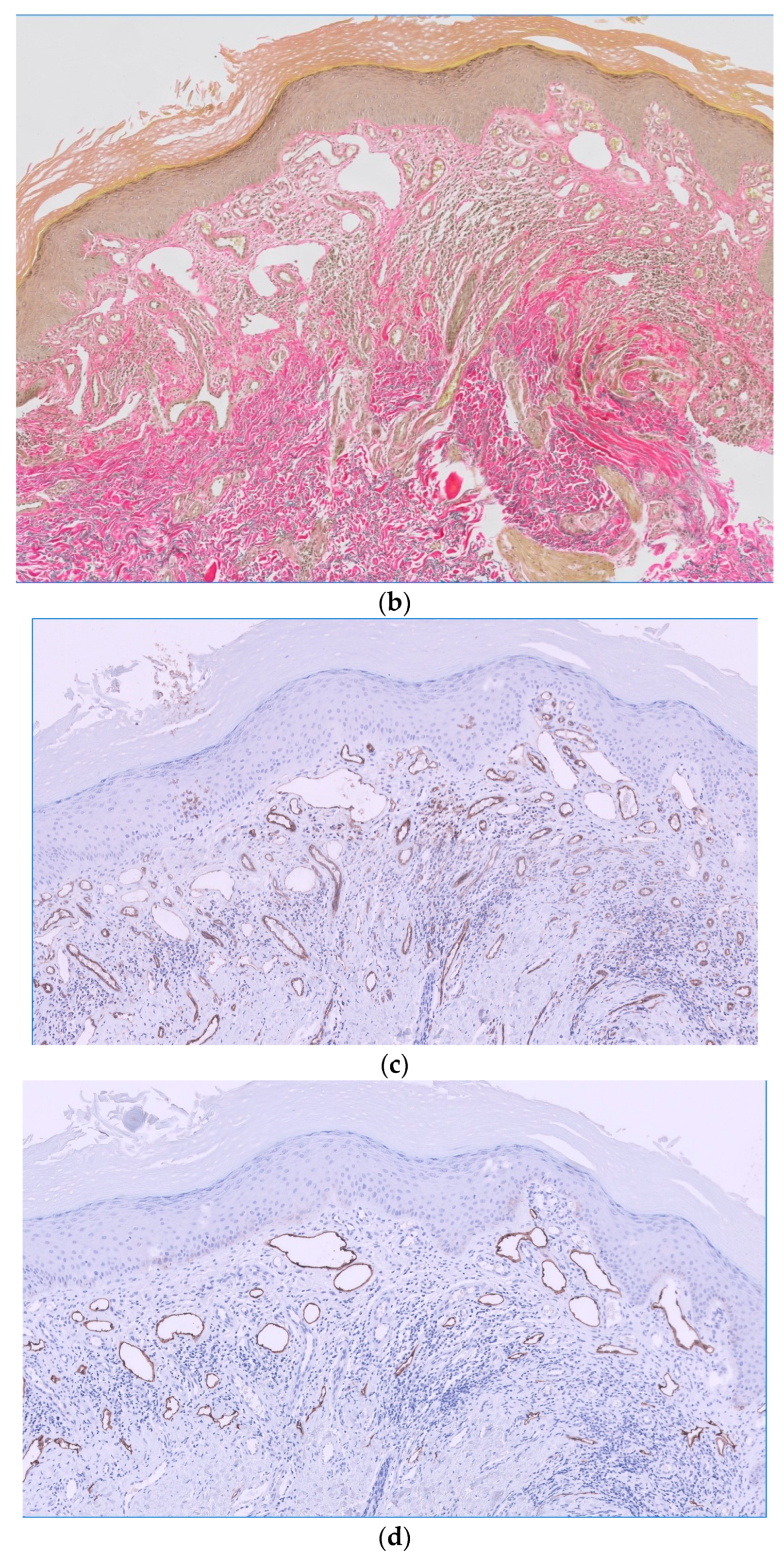 Dermatopathology 11 00015 g002b