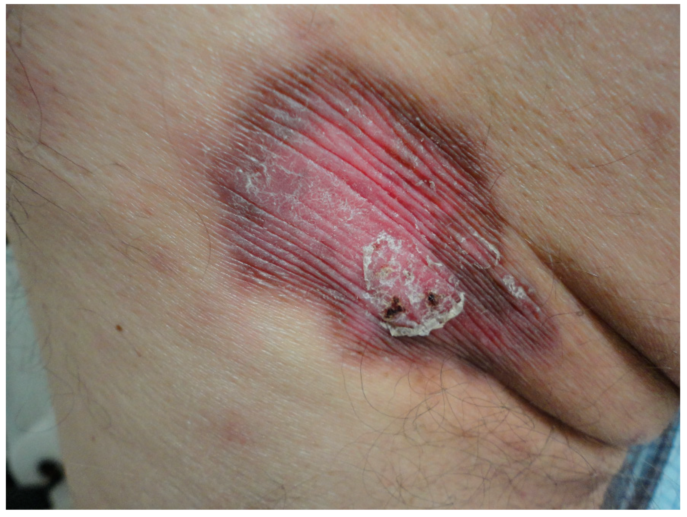 Dermatopathology 11 00015 g003