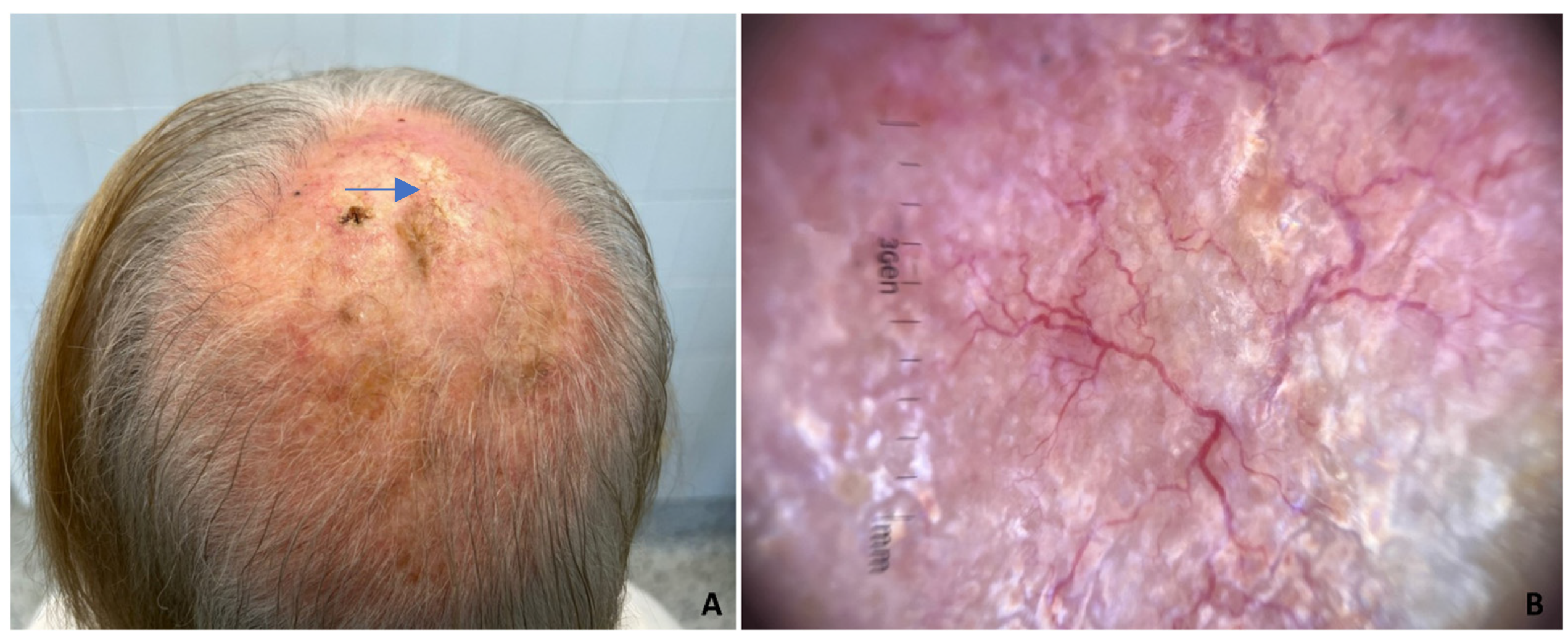 Dermatopathology 11 00016 g001