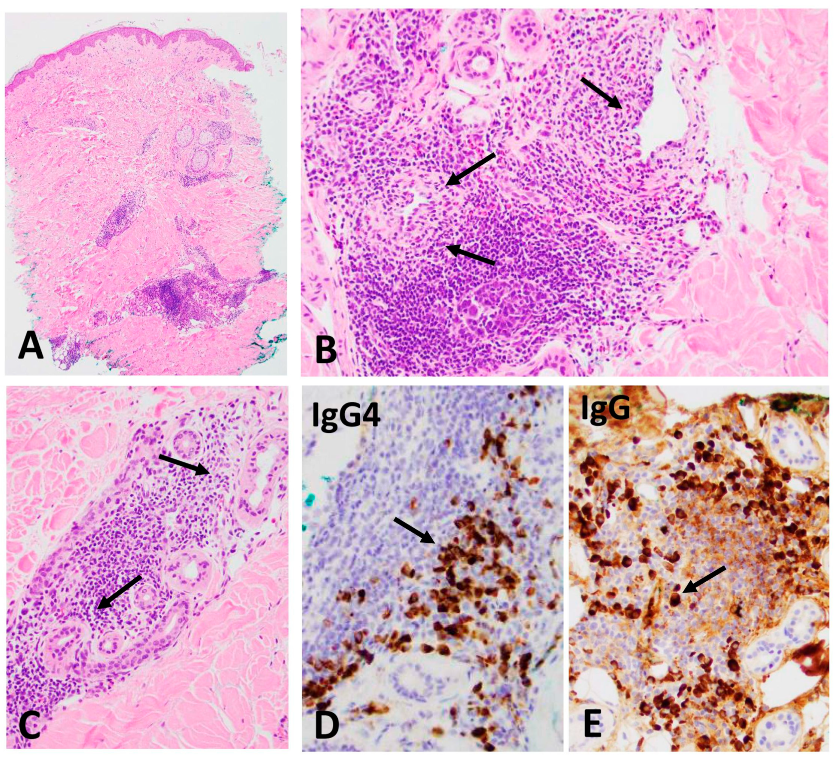 Dermatopathology 11 00023 g002