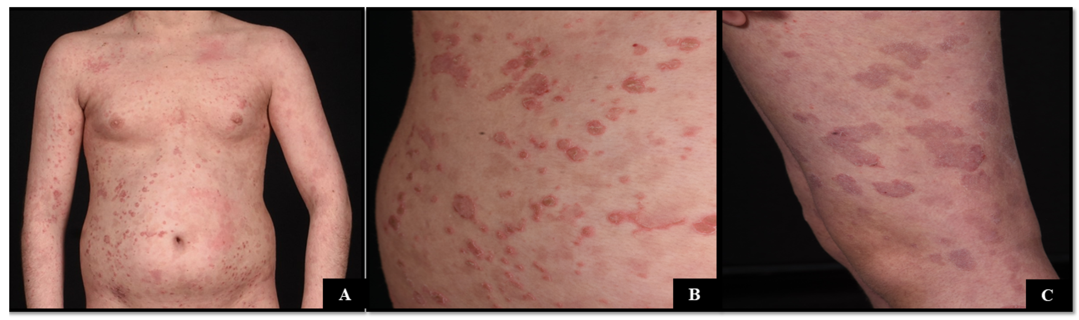 Dermatopathology 11 00024 g001