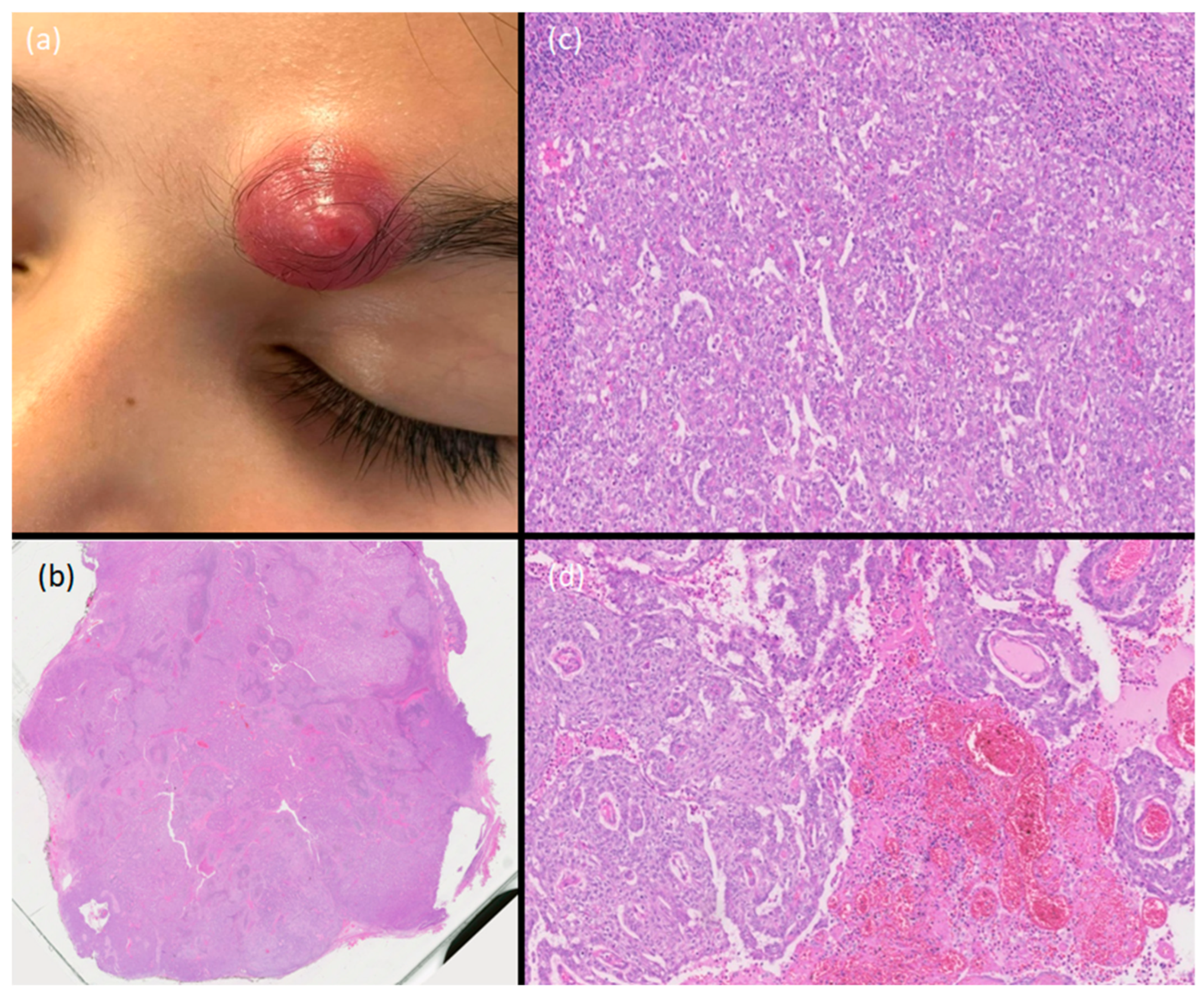 Dermatopathology 11 00028 g001