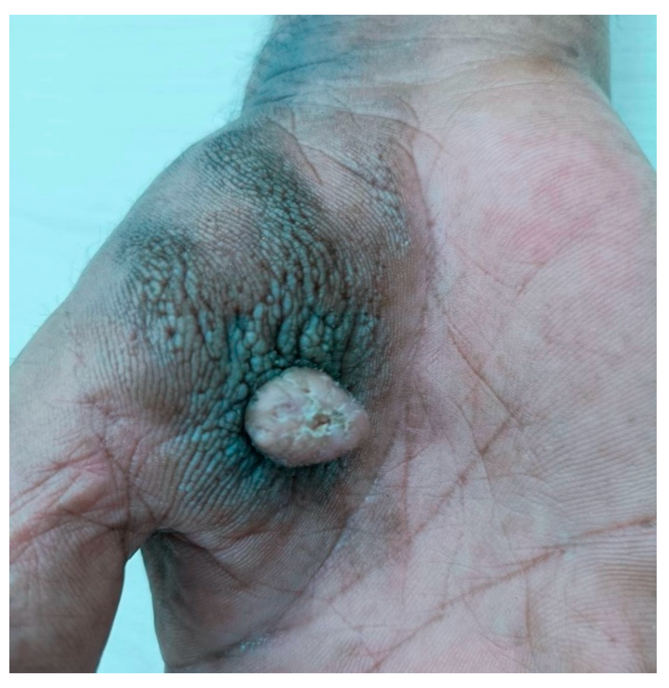 Dermatopathology 11 00030 g001